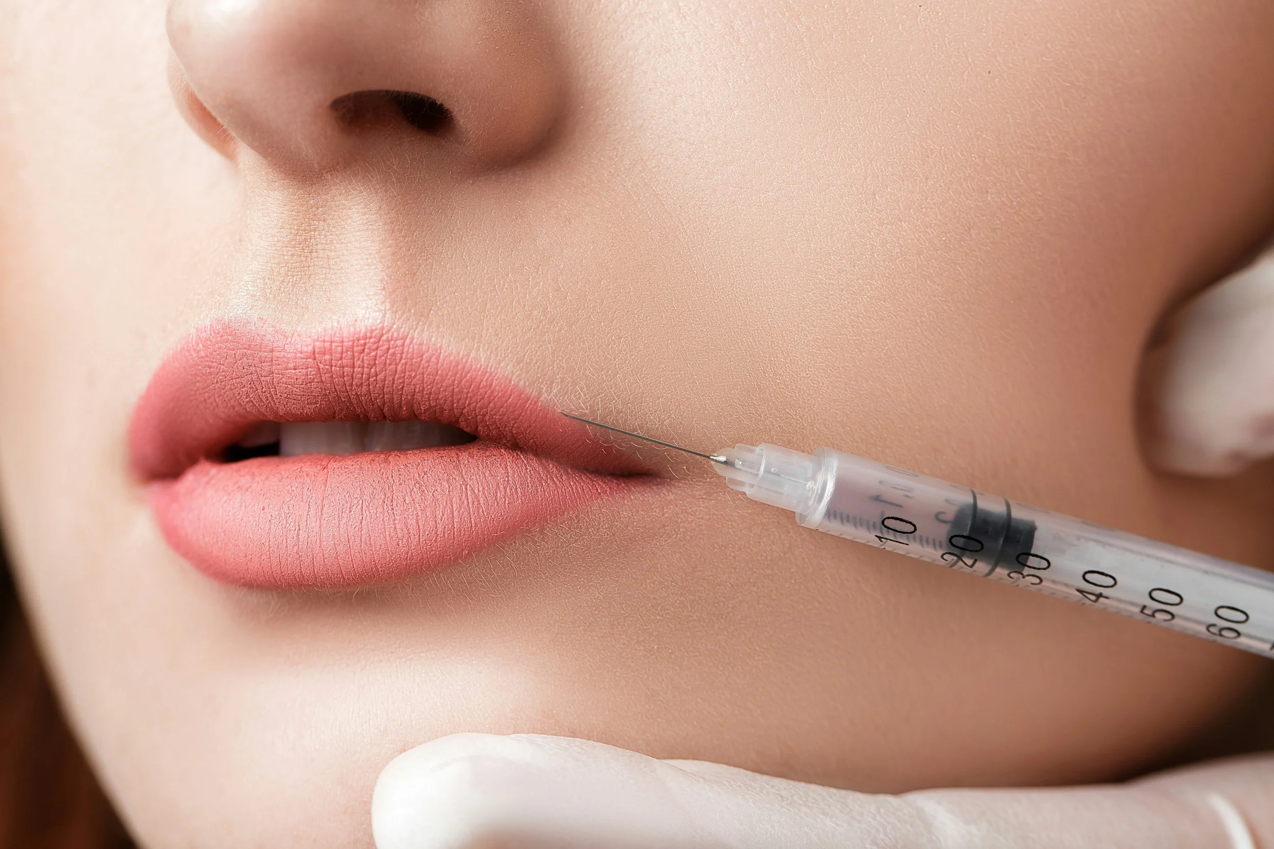 Medspa in Rocklin, CA 95677 l Dermal Fillers Near Me