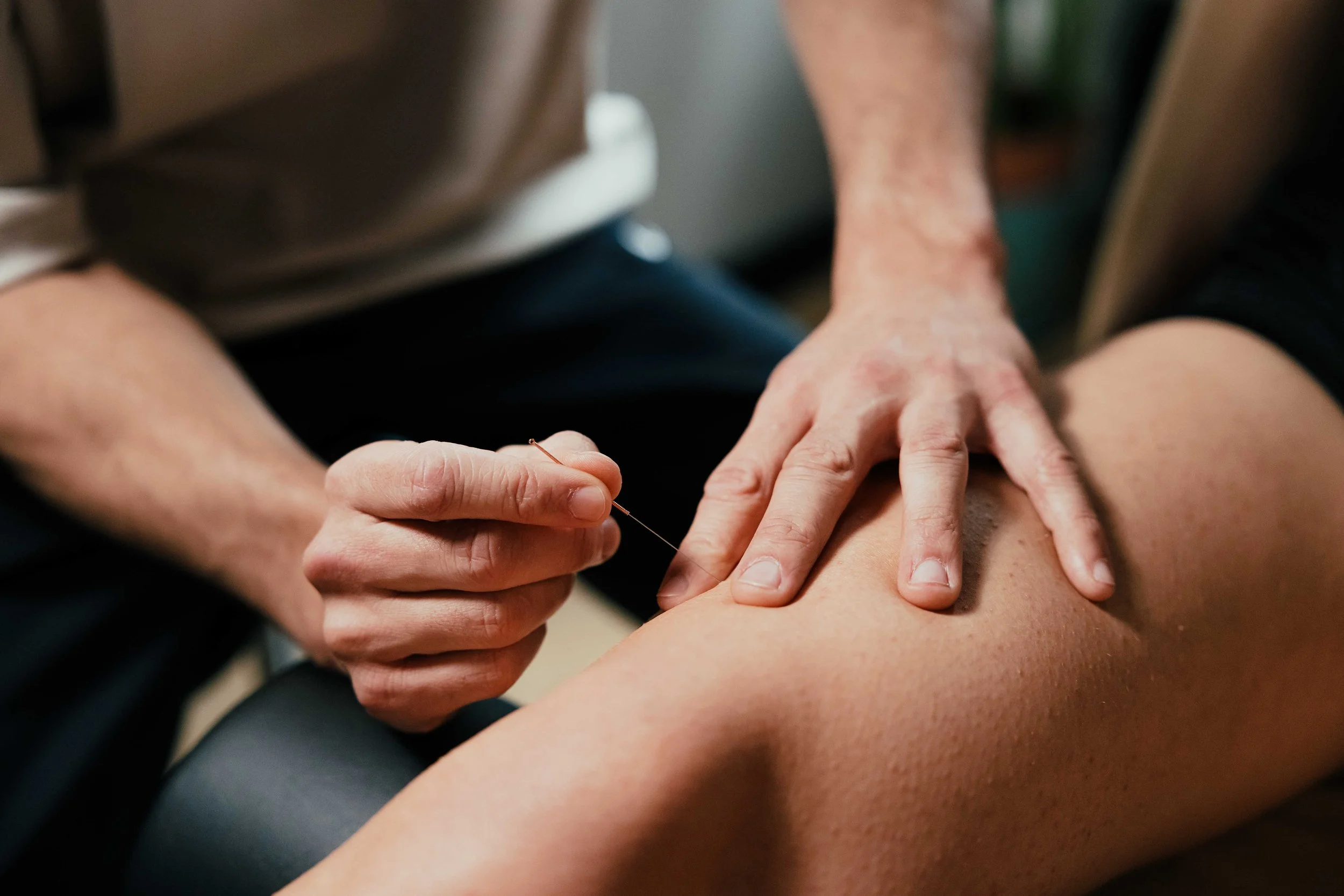 Dry needling behandeling bij spierspanning — fysiotherapie Weesp