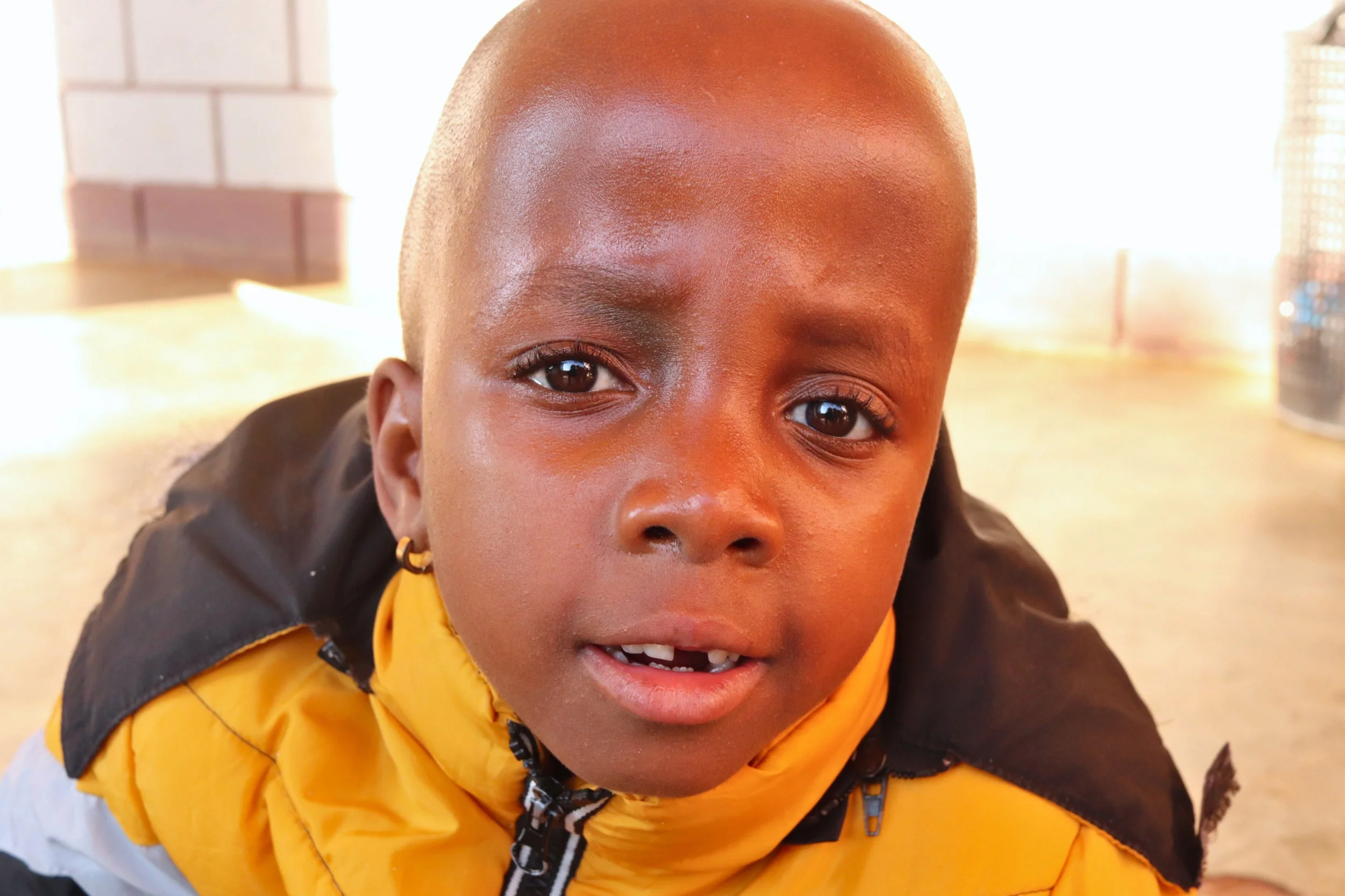 Close-up of a young boy with a shaved head, wearing a yellow jacket, looking up at the camera indoors.