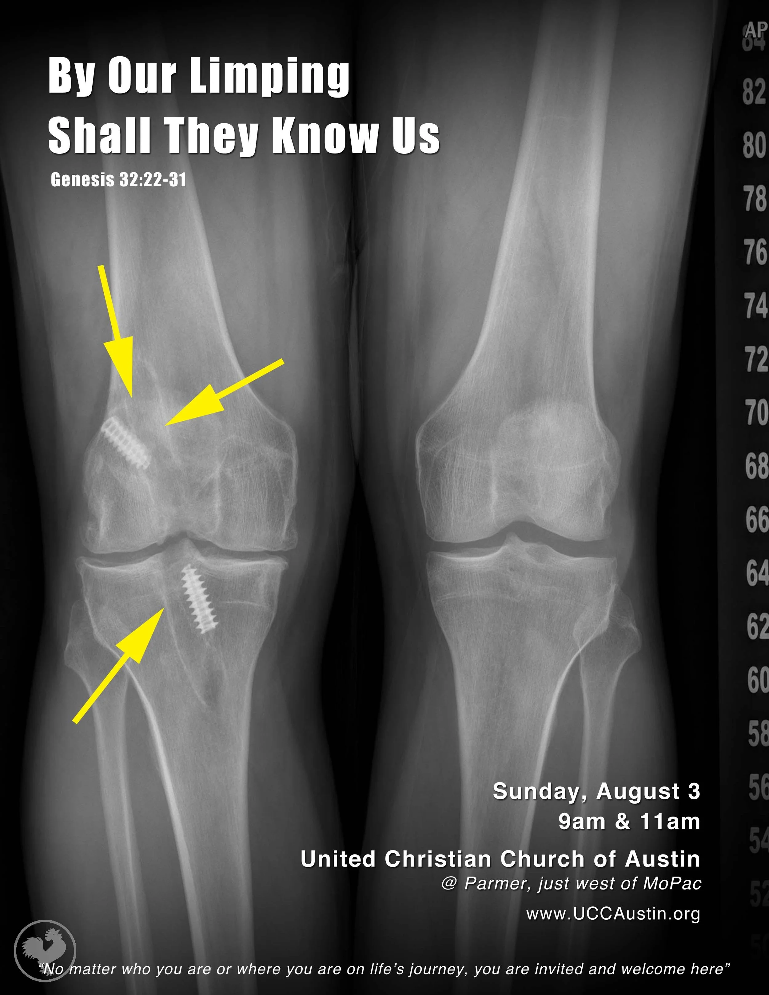 2014-08-03 By Our Limping.jpg