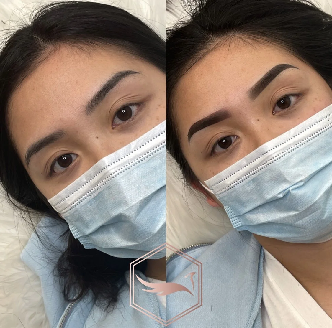 brow-coverup-san-francisco-5