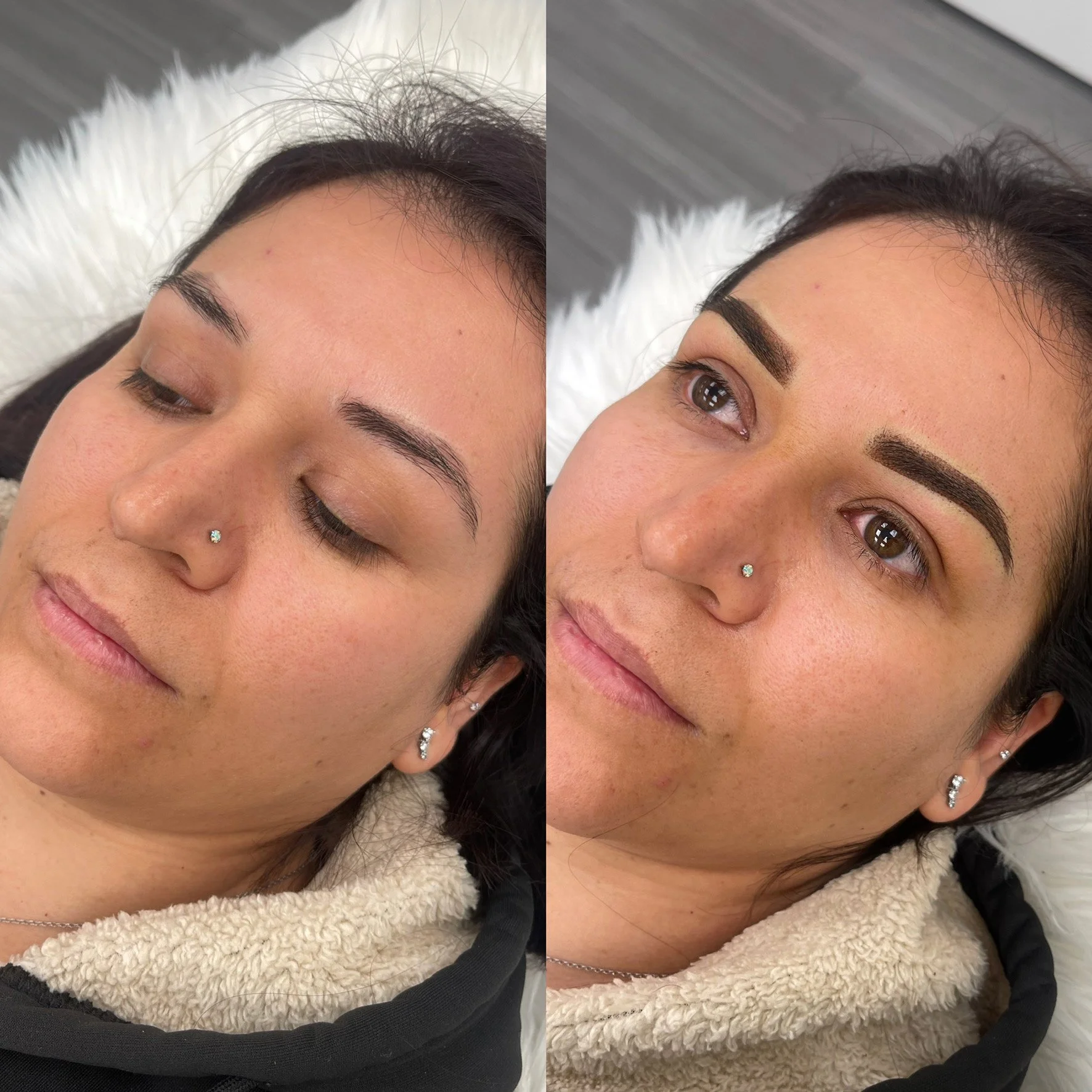 brow-coverup-san-francisco-3