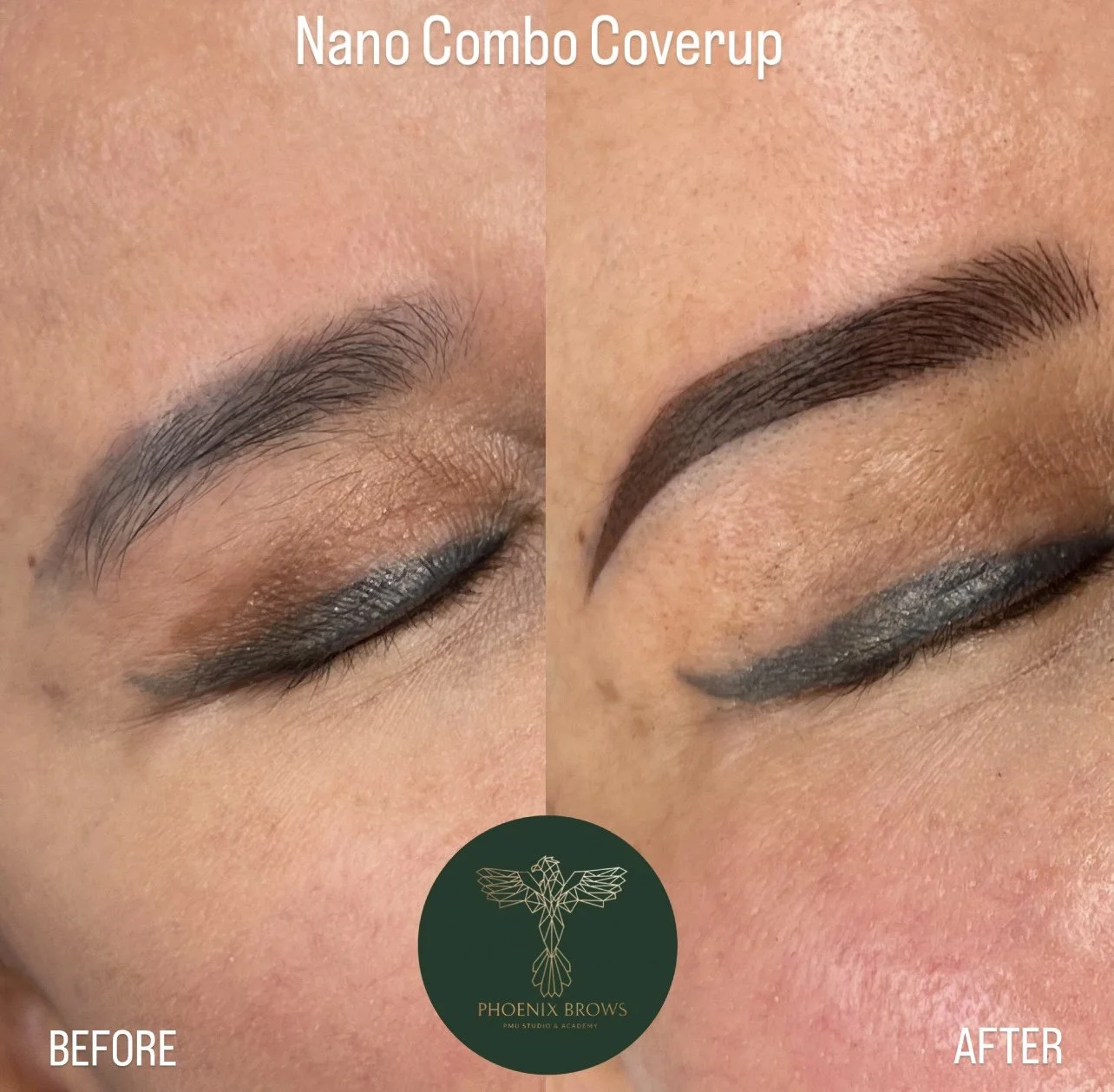 brow-coverup-san-francisco-4