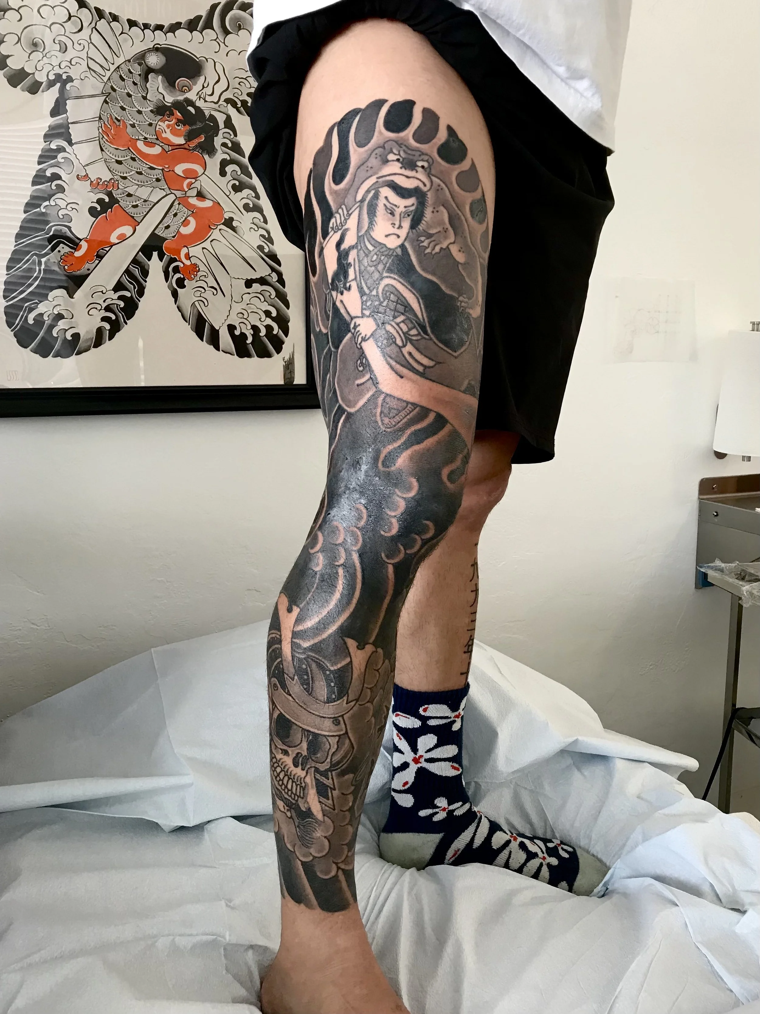A person with a large, detailed Japanese-style tattoo on their leg featuring a warrior, clouds, waves, and a skull. The person is standing on a medical bed, wearing shorts and colorful socks.