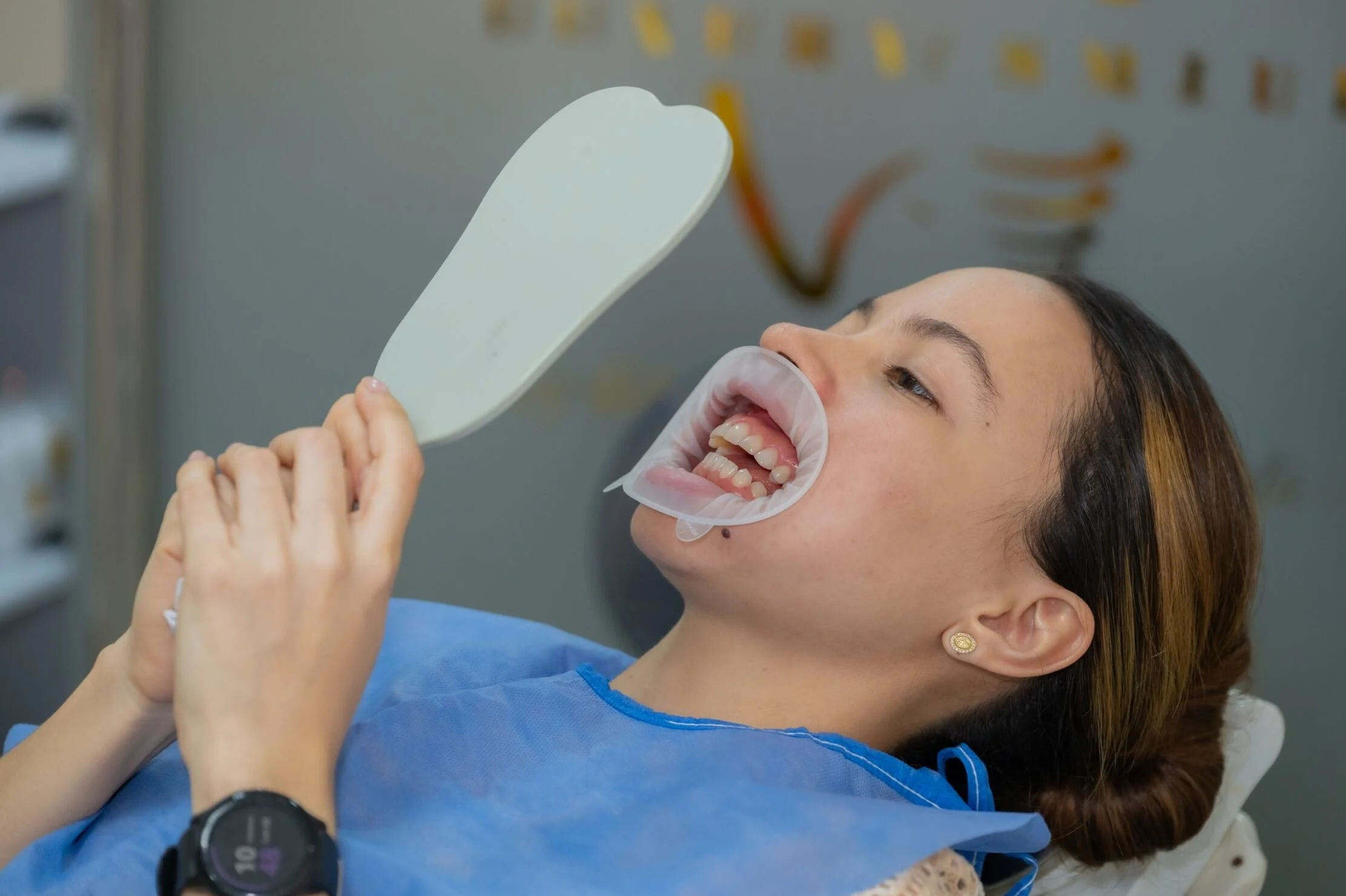 Rehabilitación oral