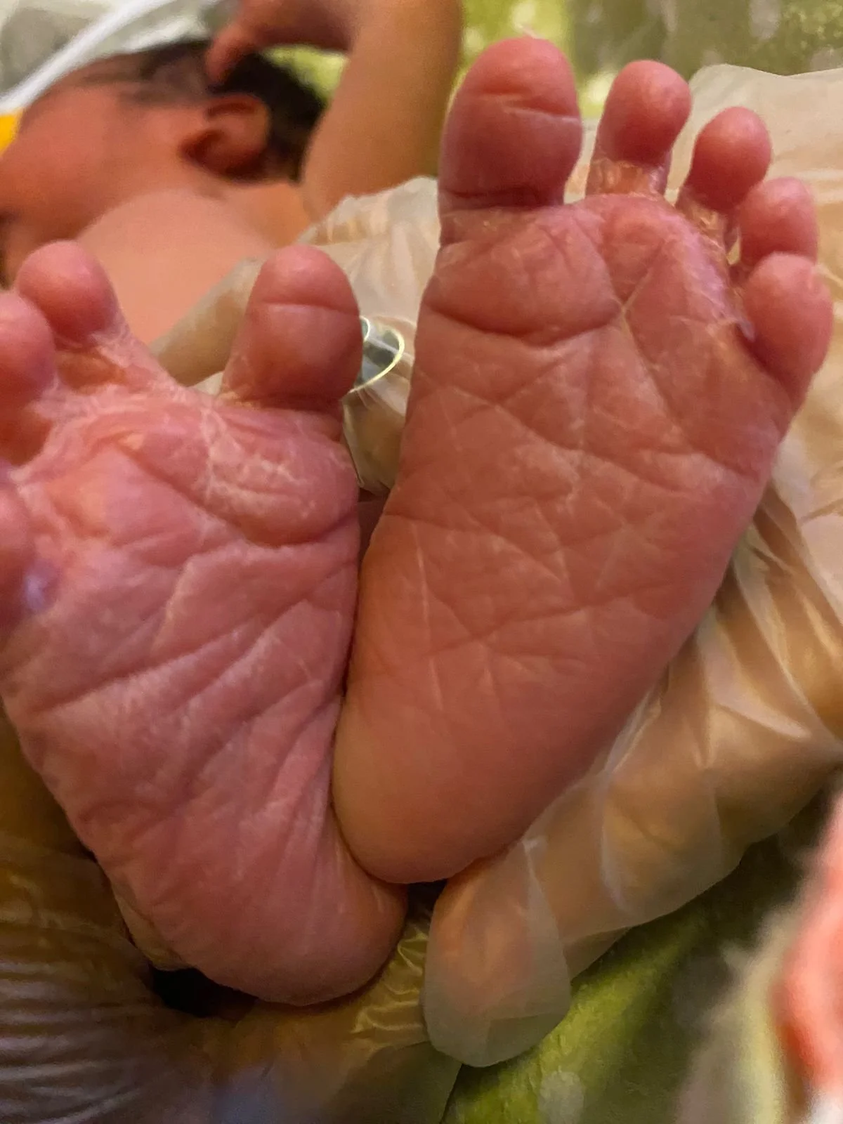 Close-up of baby's feet, showing wrinkled and pink soles, with a person lying in the background.