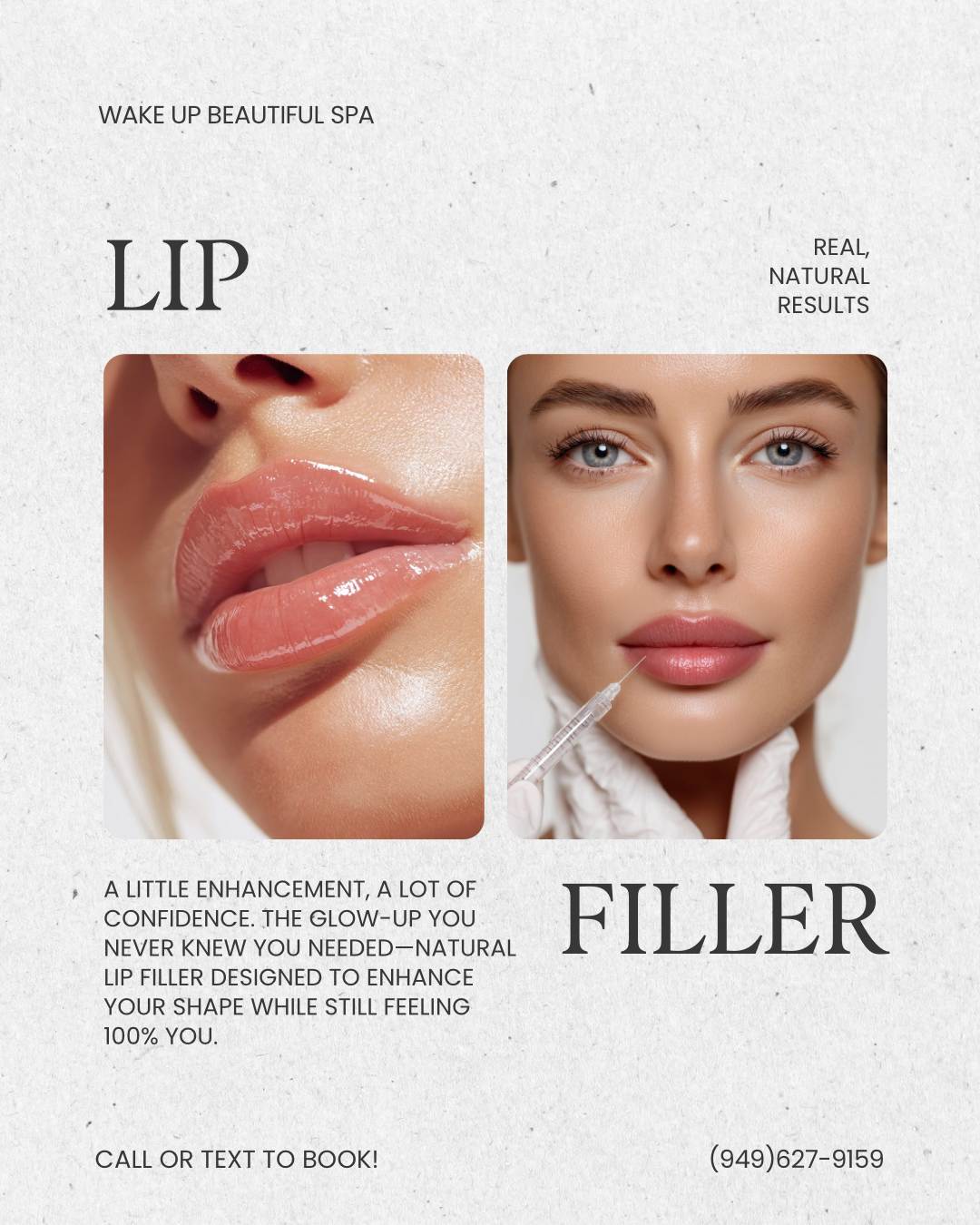 lip filler (WUB).PNG