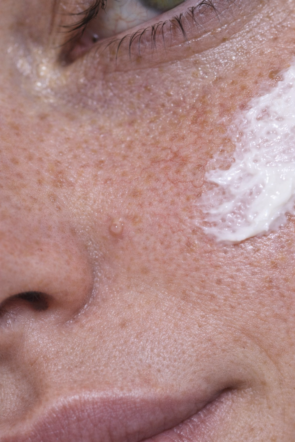 Close-up of a person's face with white cream applied to their cheek, showing skin texture and pores. Custom AI model, AI influencer.