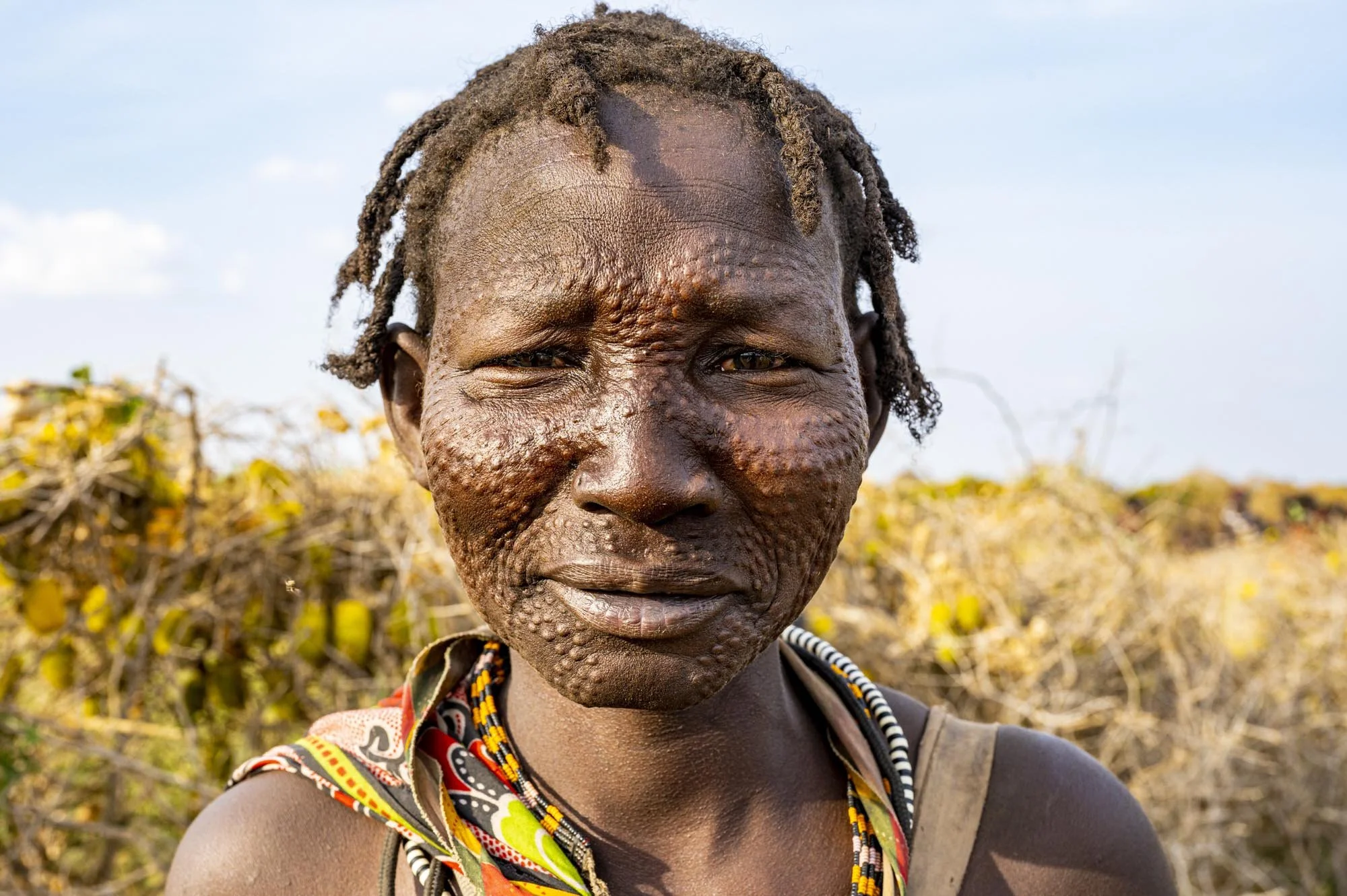 Close-up of an indigenous woman with textured skin and traditional jewelry outdoors.