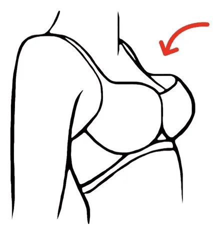 Line drawing of a woman’s upper body wearing a bra, with an arrow pointing to her shoulder area.