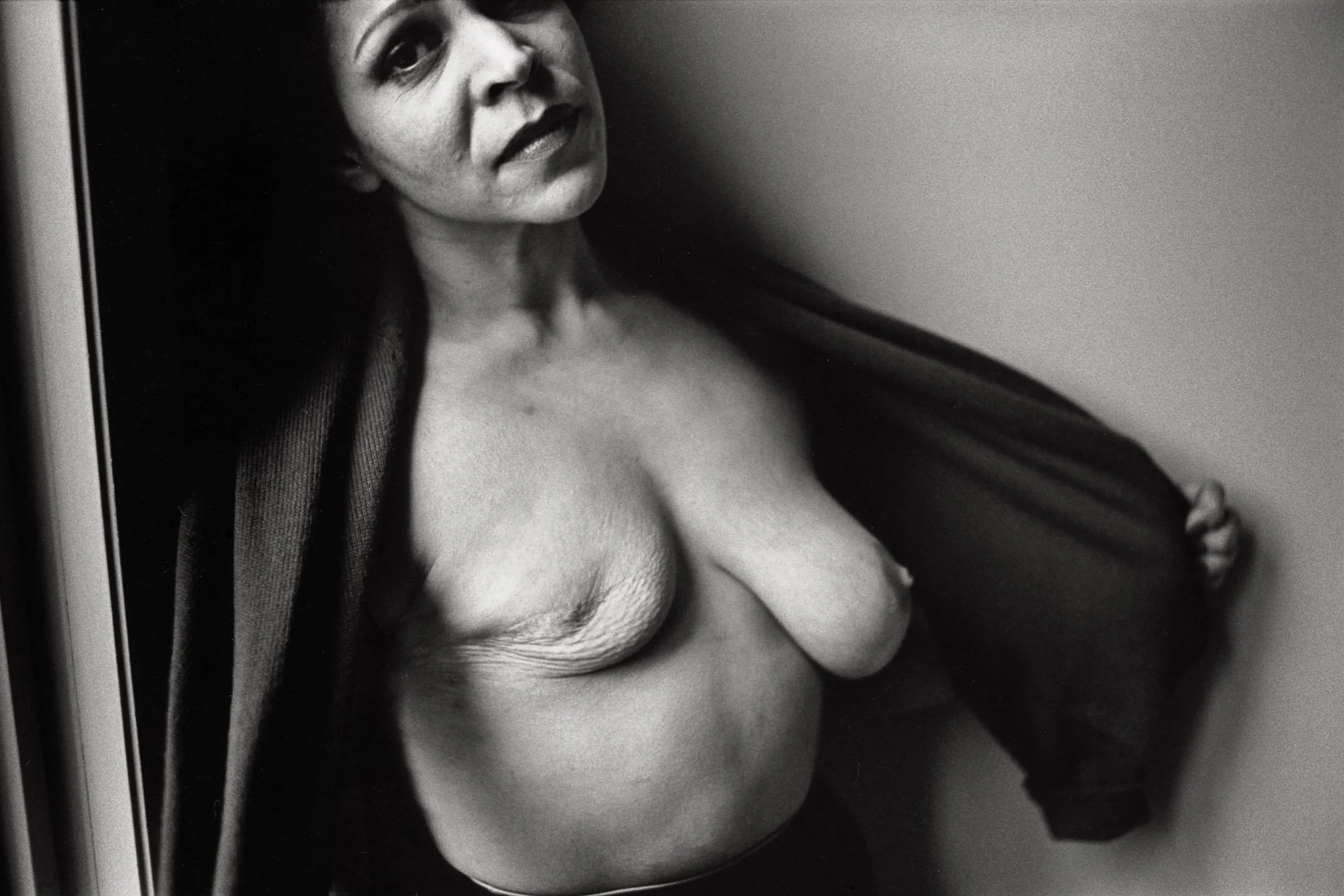 A woman with a mastectomy open her shirt to reveal herself, physically but also emotionally.
