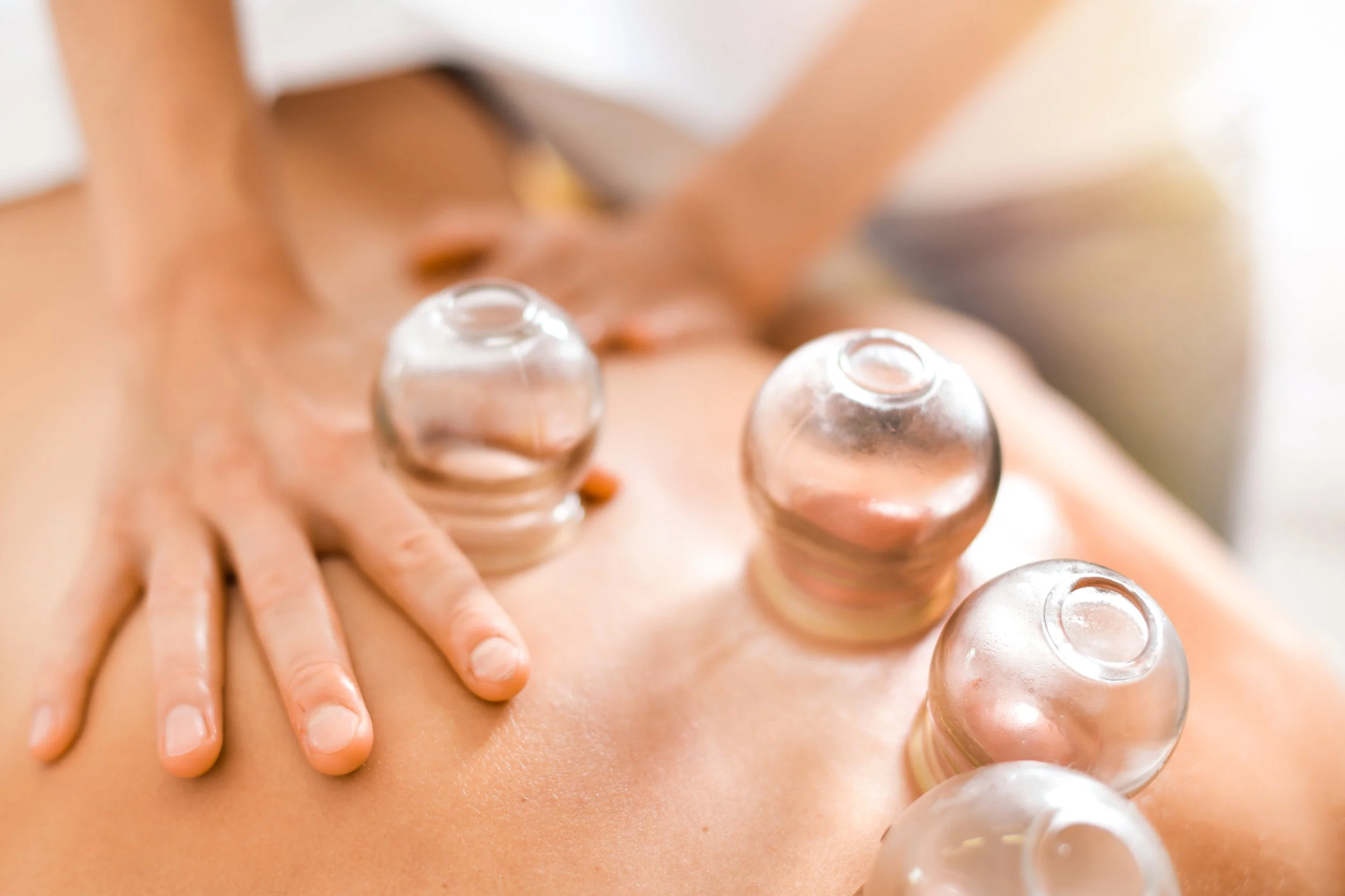 Cupping/ Tui Na
