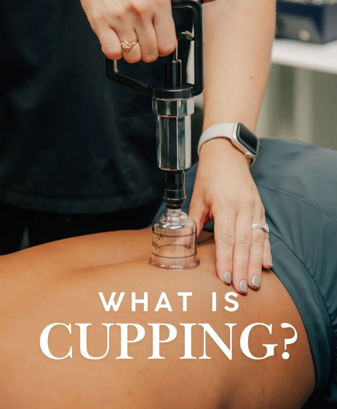 Cupping isn&rsquo;t magic ✨ and no, it&rsquo;s not &ldquo;pulling toxins out&rdquo; of your body.

So what is it? 
Cupping is simply a gentle way to change pressure in tissues, calm the nervous system, and help sensitive or tight areas move and feel 