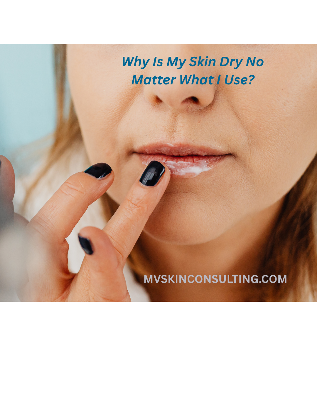 Why Is My Skin Dry No Matter What I Use?
