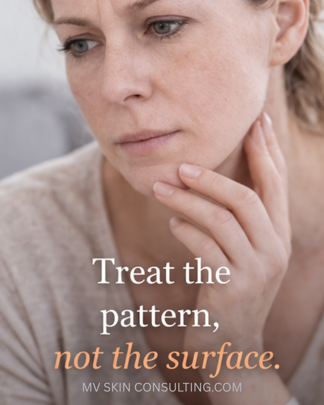 What Do Facial Lines Actually Mean? (And Can They Improve Naturally?)