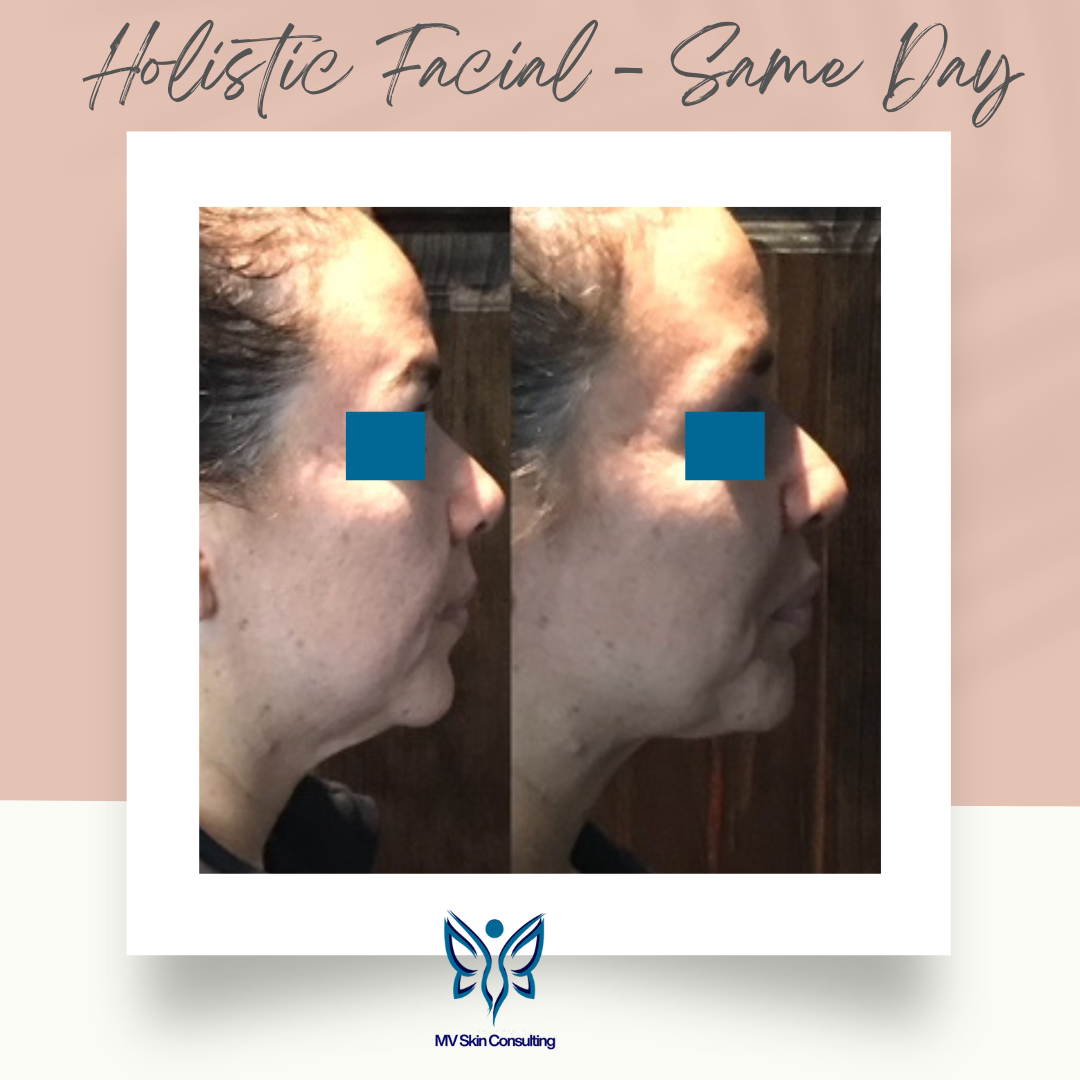 MV Skin Consulting's Skin Fitness Facials can firm, lift, and tone the face and neck...located inside Cornerstone Pilates in Richardson, TX