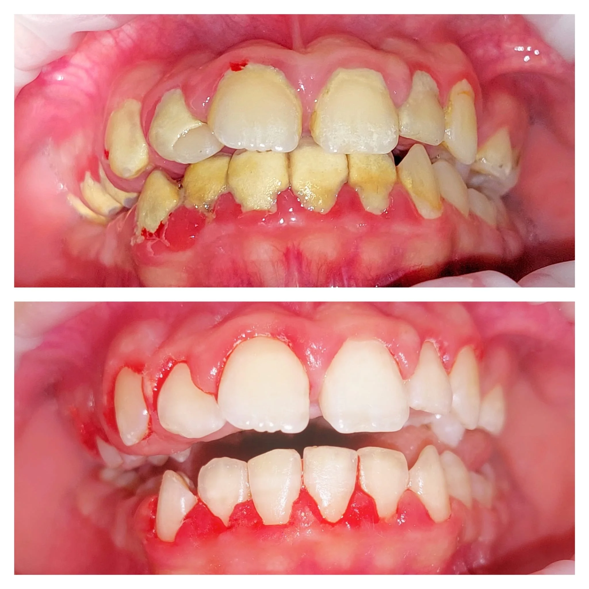 e-book: "The Complete Guide to Oral Hygiene"