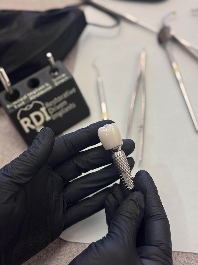 Close-up of a dental implant with a crown being held by hands in black gloves, dental tools on a table in the background.