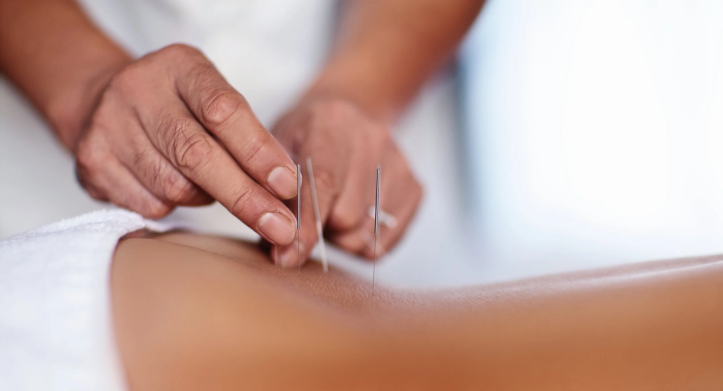 Does Acupuncture Hurt? What to Expect at Your First Visit