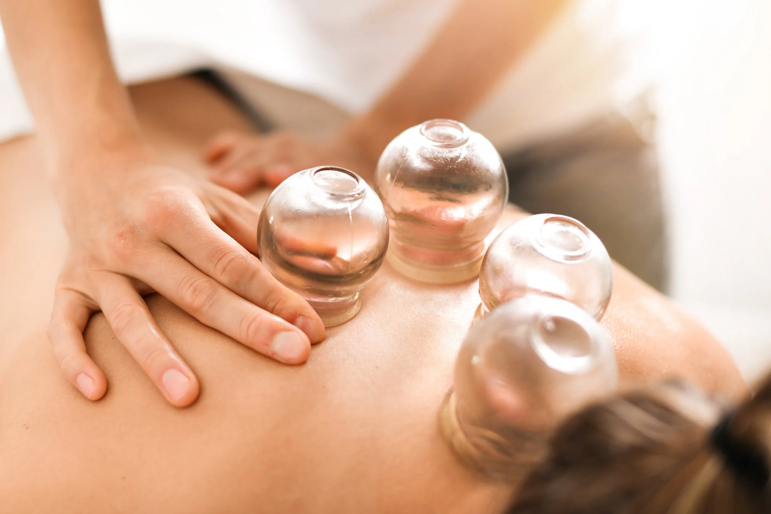 Cupping Therapy: A Gentle Way to Release Tension and Support Healing