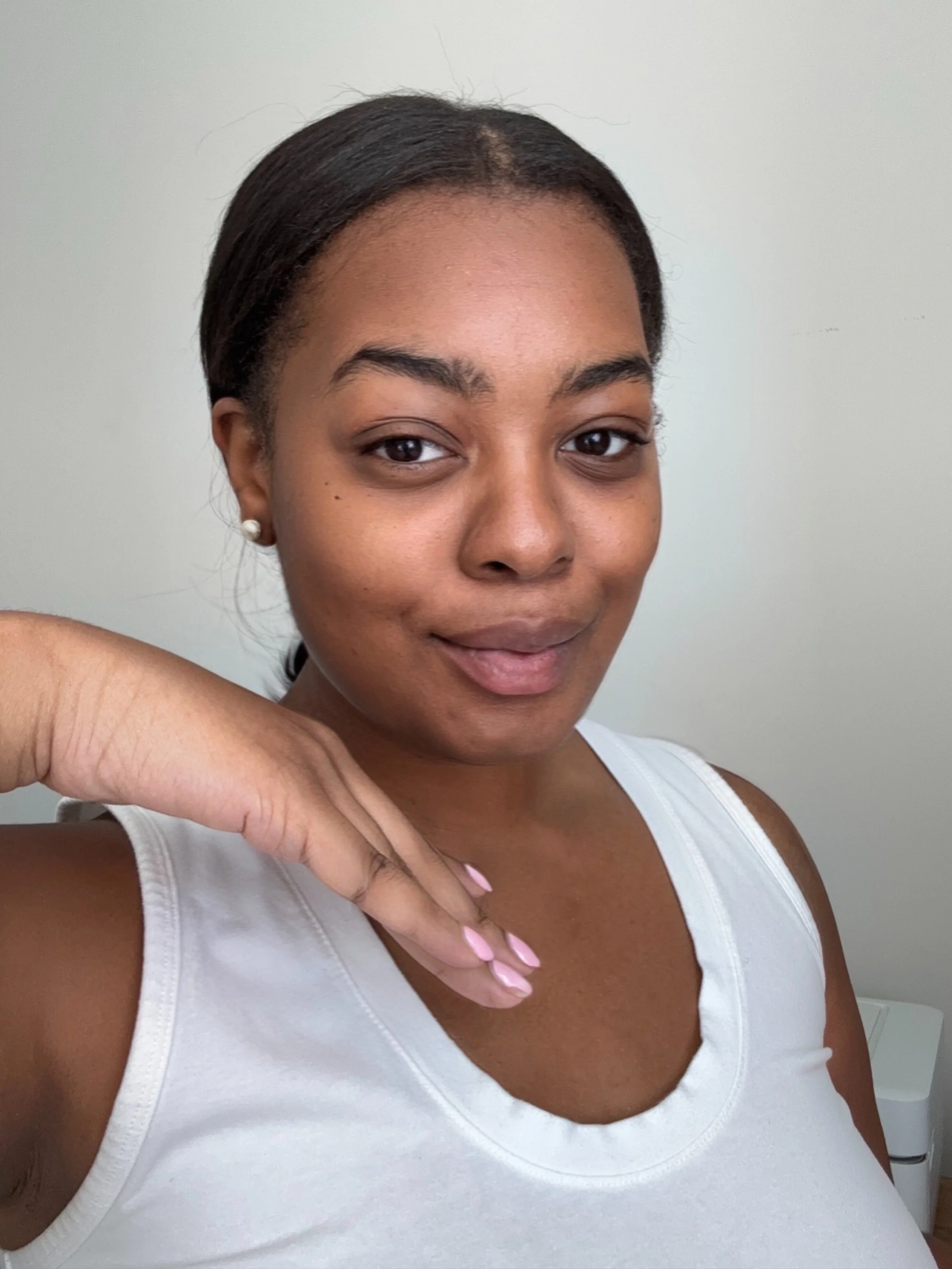 ACNE: The Main Drivers &amp; Foundations For Clear Skin