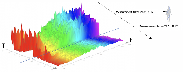 Reduced antenna effect after 48 hours with VIVOBASE