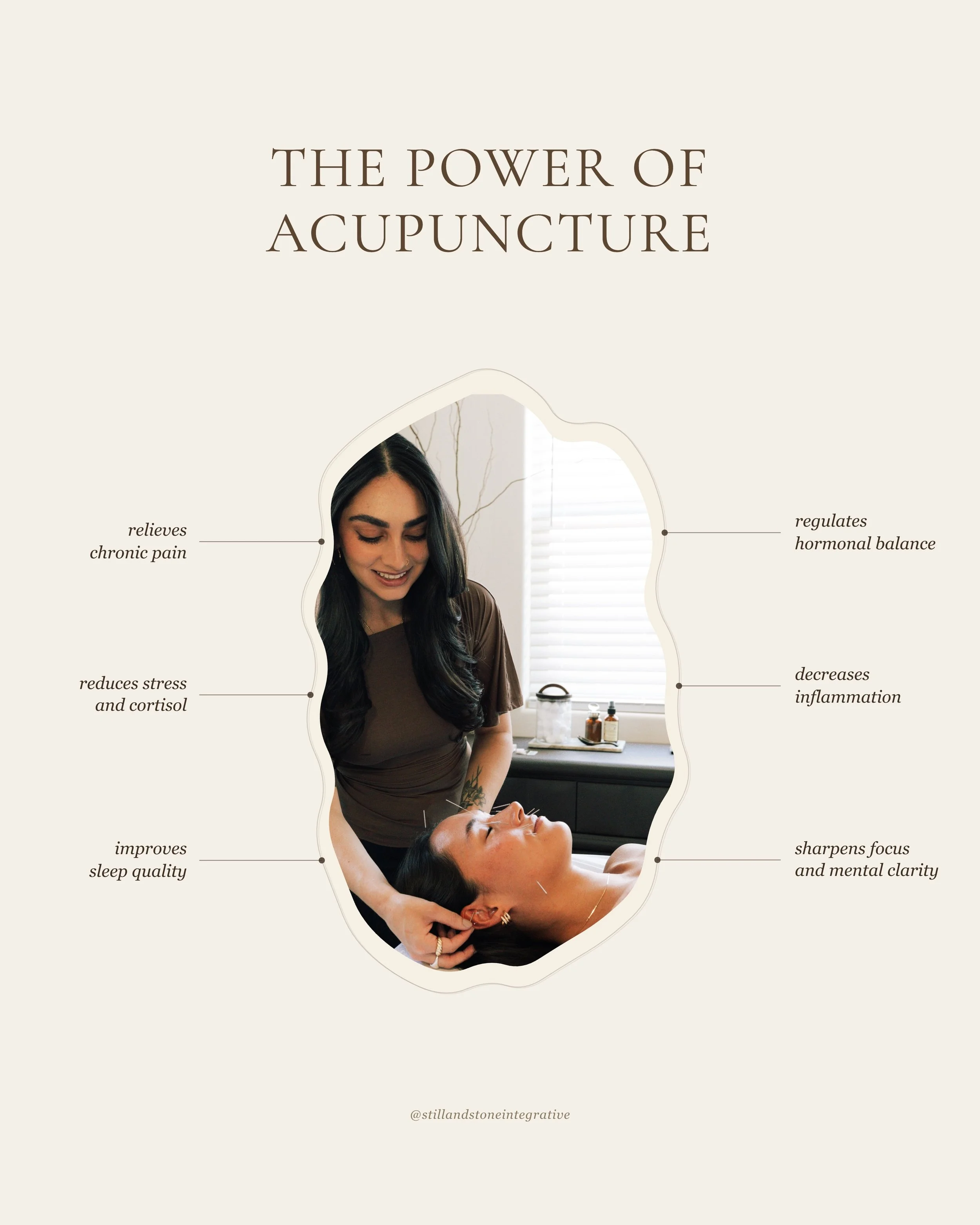 The power of acupuncture 🪡
📍 Flagstaff, AZ
#acupuncture #flagstaffaz #holistichealth #naturalhealing #acupuncturebenefits