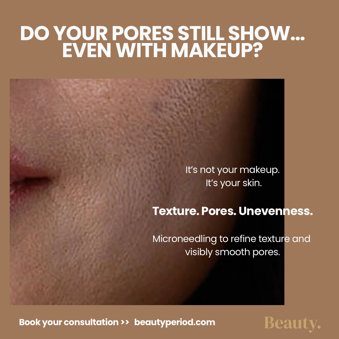 Why Your Skin Still Looks Textured…(Even With Makeup)