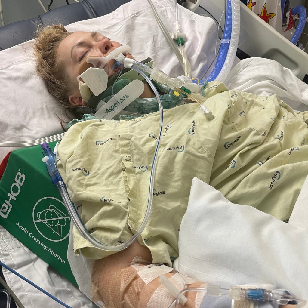 Hillary Hartnett in hospital, being treated for her brain injury