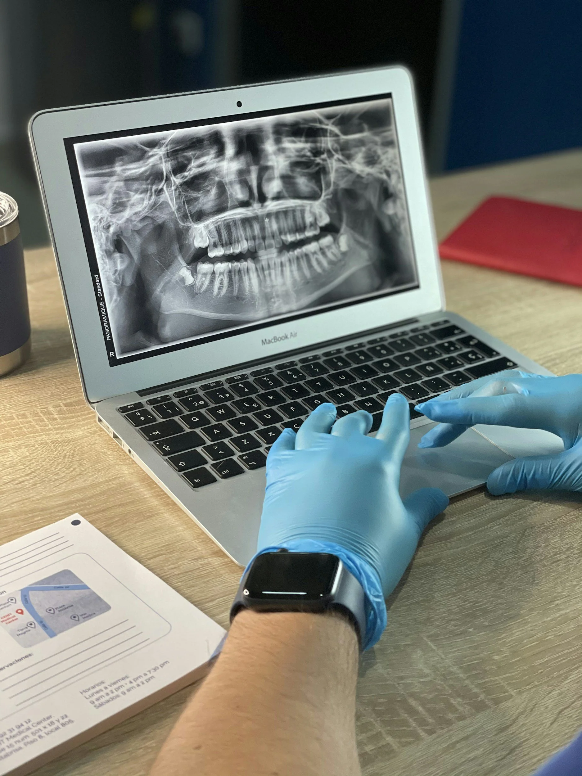 A person wearing blue gloves is holding a laptop displaying a dental X-ray of a human skull with teeth. The person is also wearing a blue wristwatch and a smartwatch. On the table, there is a pamphlet with a map and text, along with a red folder and a black container.