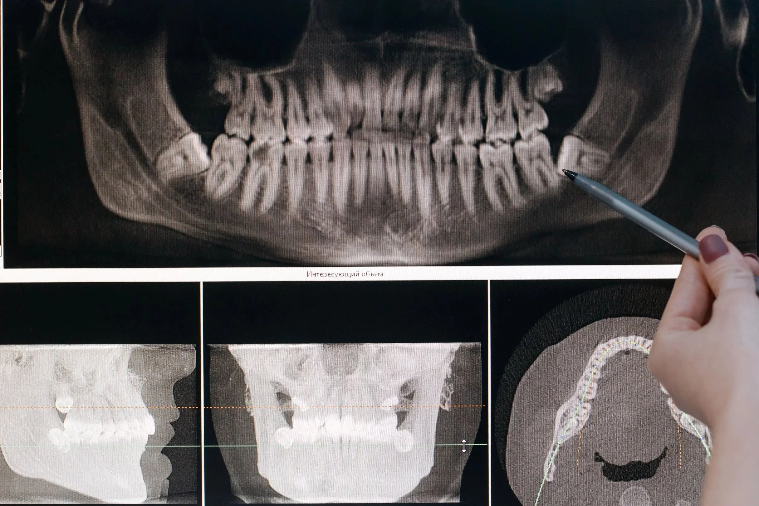 Oral Surgery