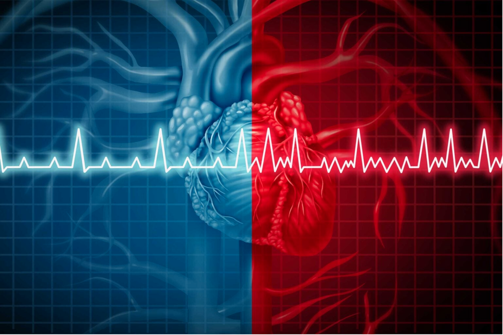 Using AI to prevent blood clots, strokes