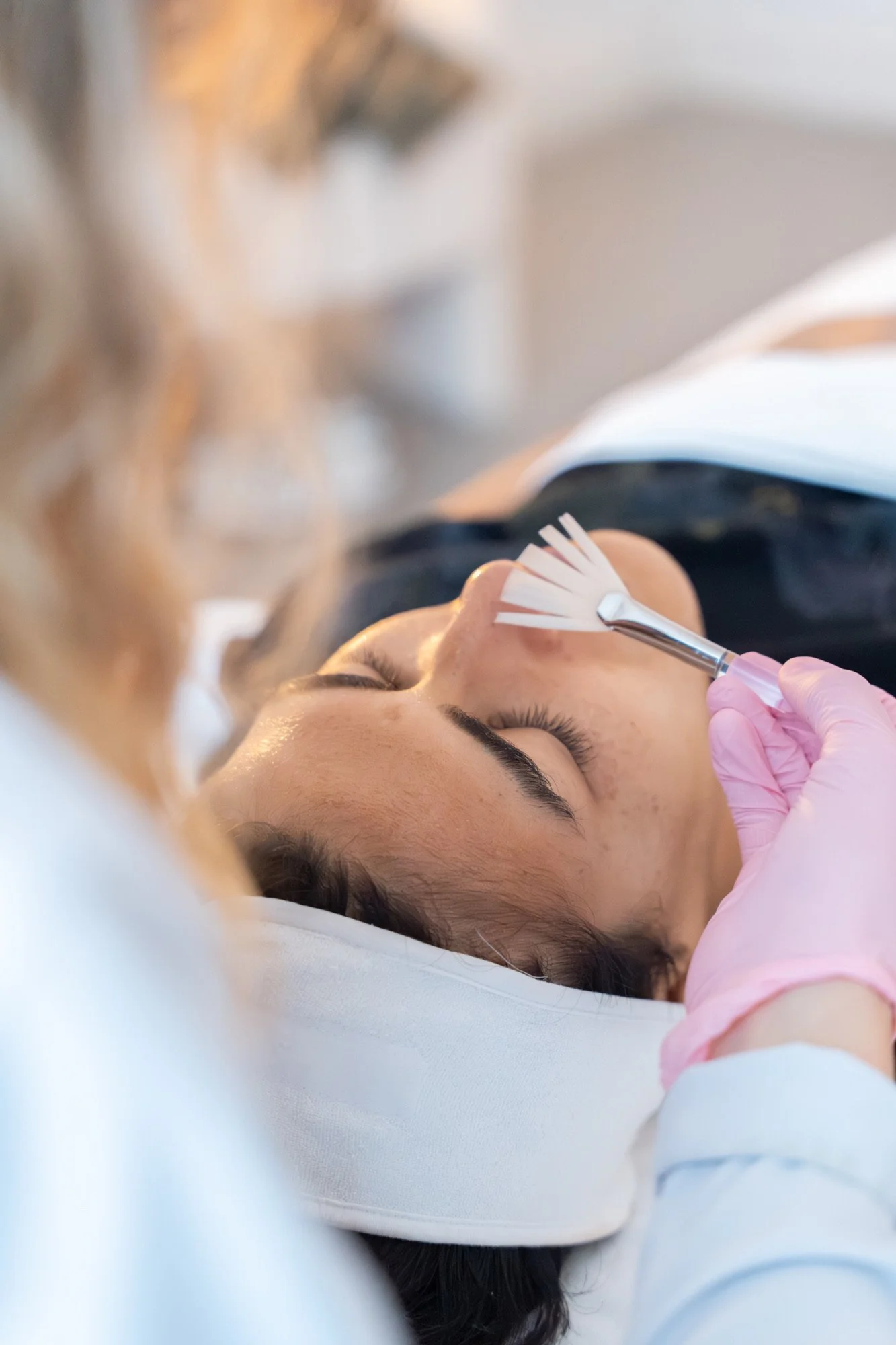 Peeling superficiel, moyen et profond