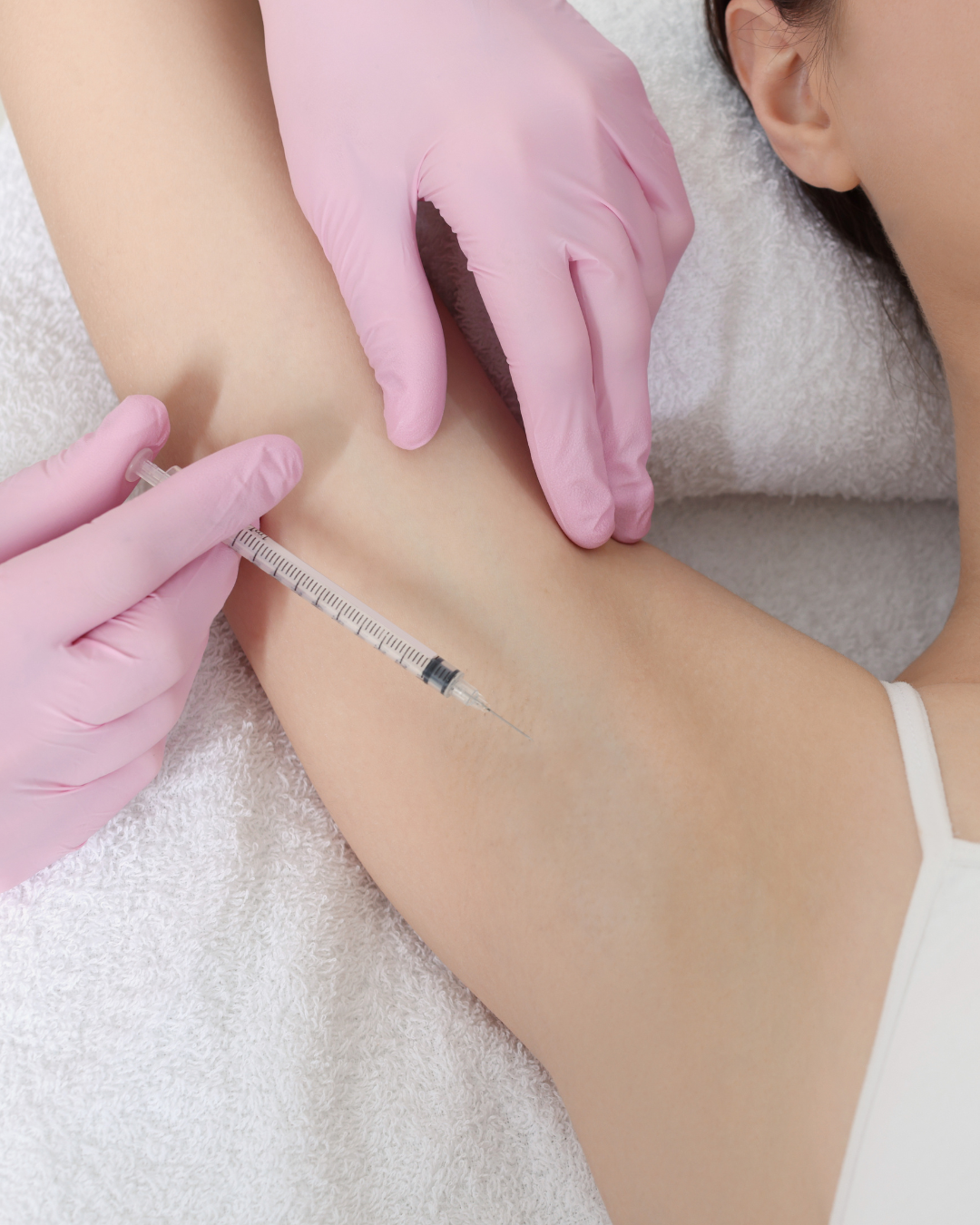 Injection de botox contre la transpiration excessive