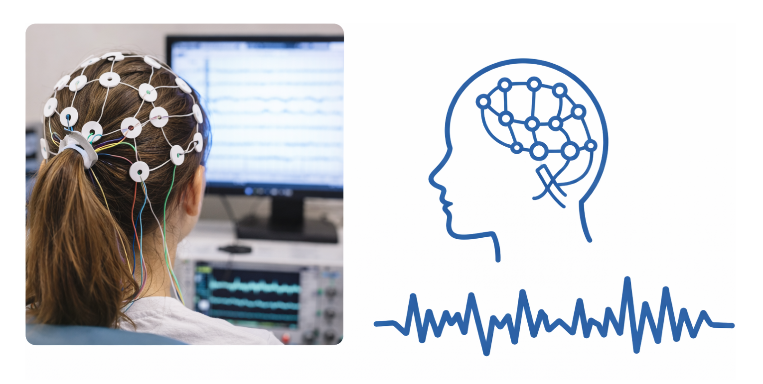 Electroencefalograma