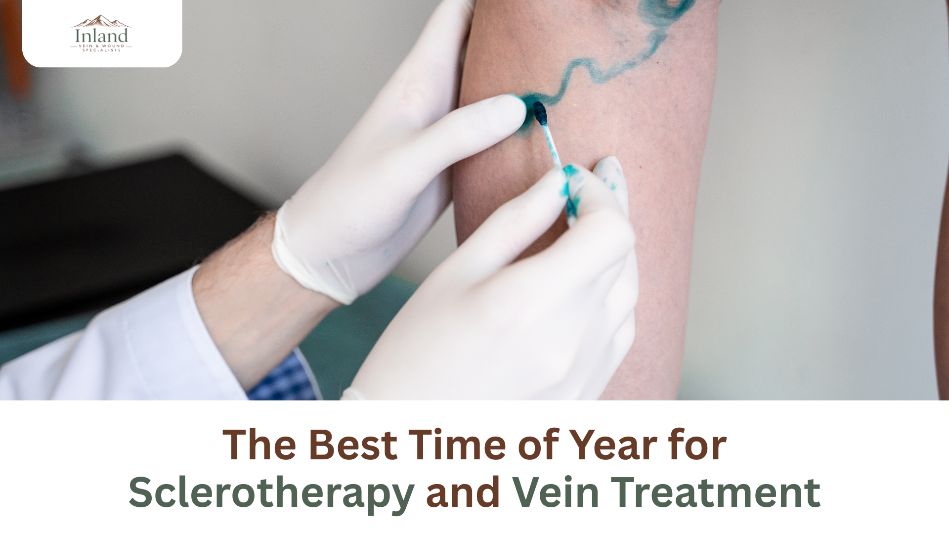 The Best Time of Year for Sclerotherapy and Vein Treatment