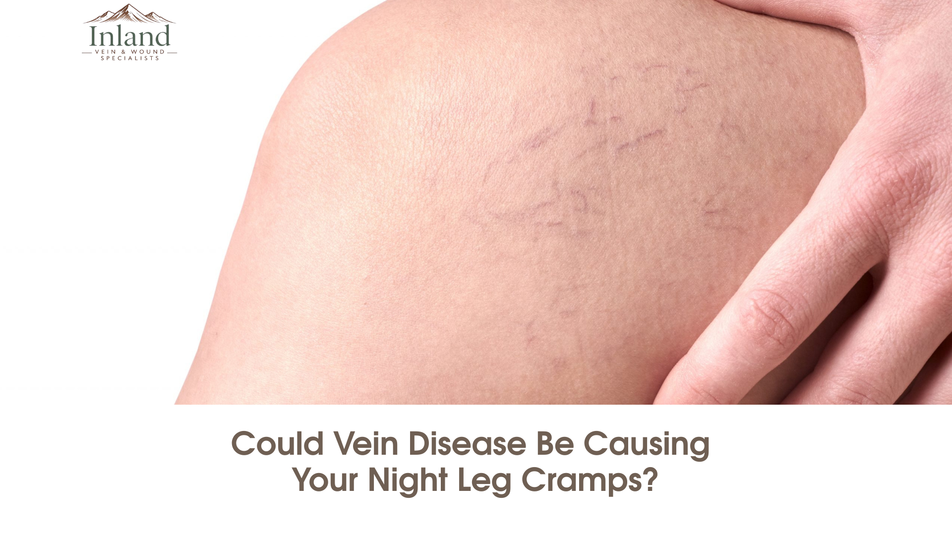 Could Vein Disease Be Causing Your Night Leg Cramps?