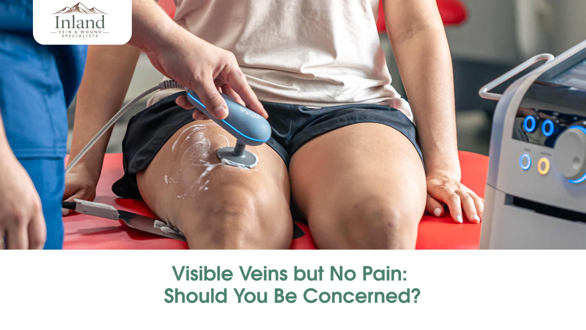 Visible Veins but No Pain: Should You Be Concerned?
