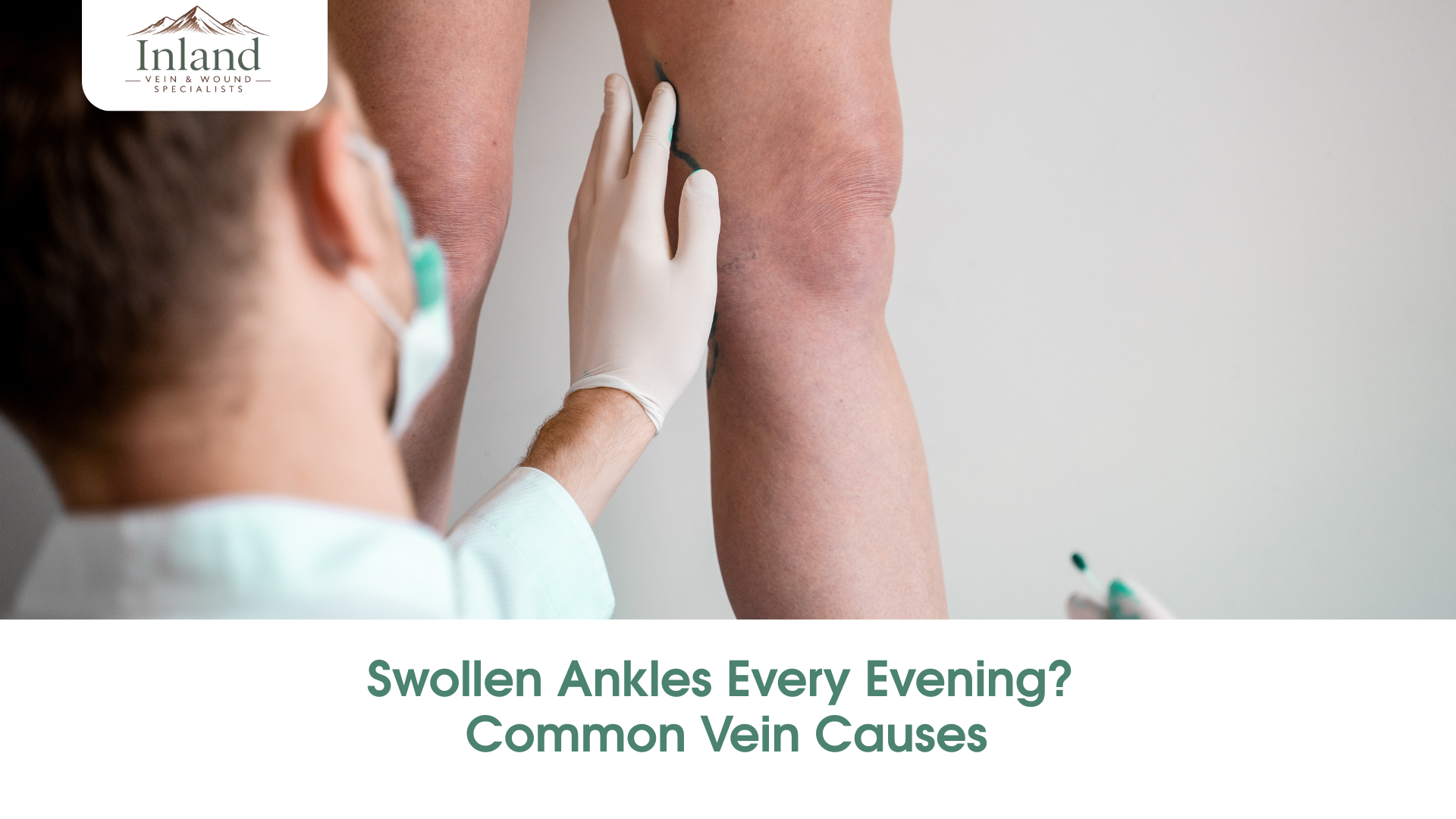 Swollen Ankles Every Evening? Common Vein Causes