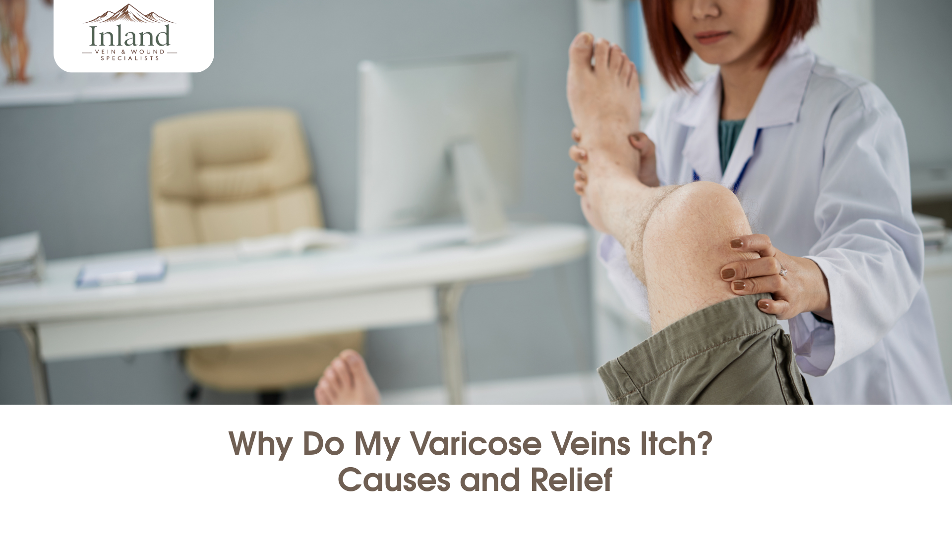 Why Do My Varicose Veins Itch? Causes and Relief