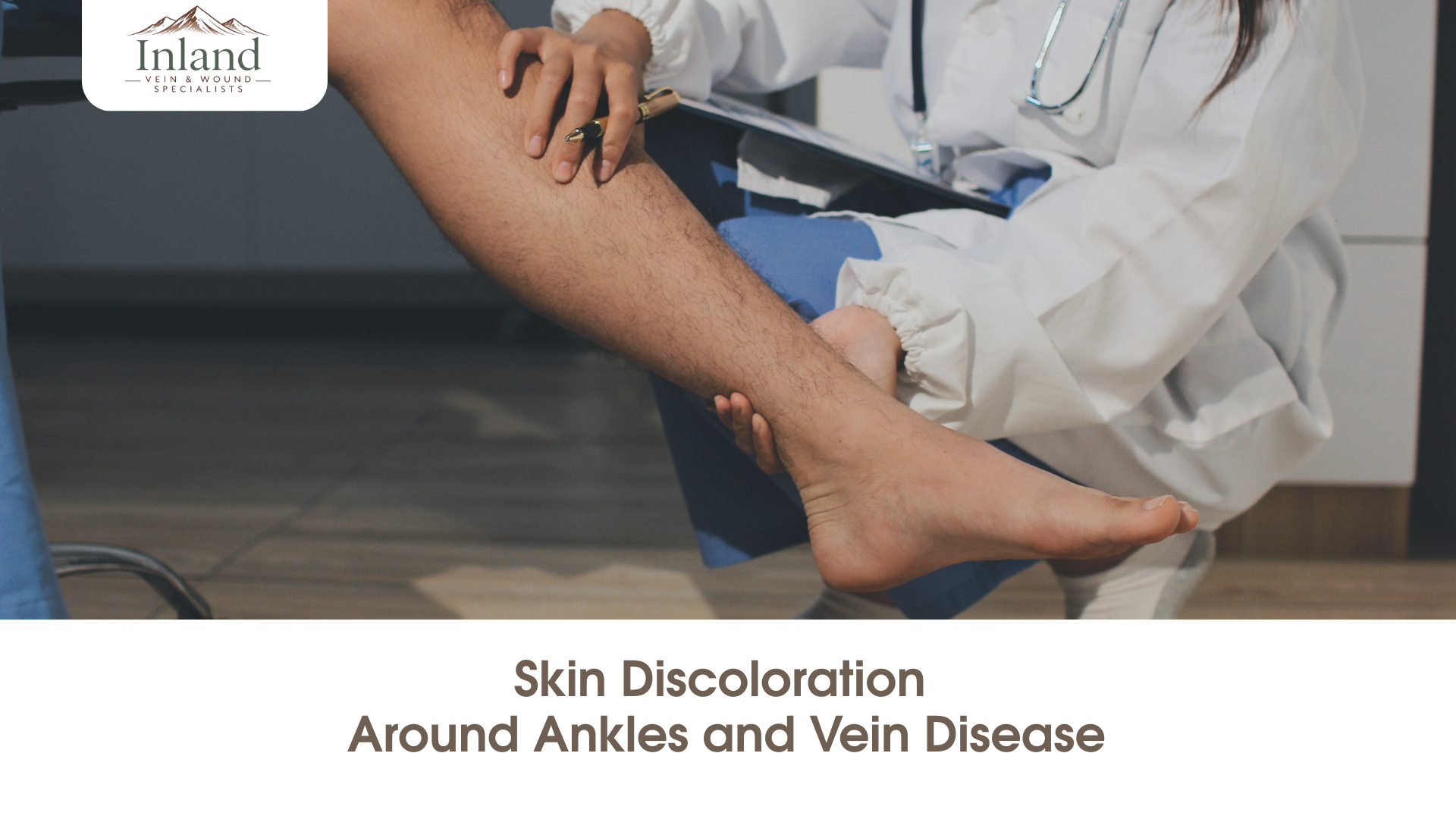Skin Discoloration Around Ankles and Vein Disease