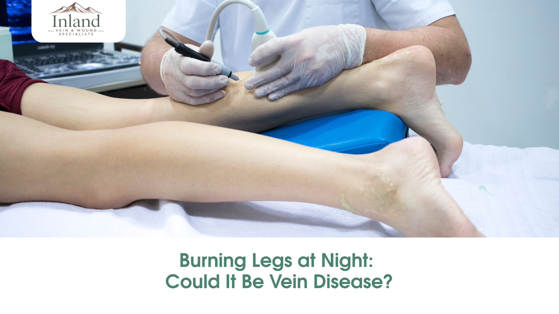 Burning Legs at Night: Could It Be Vein Disease?
