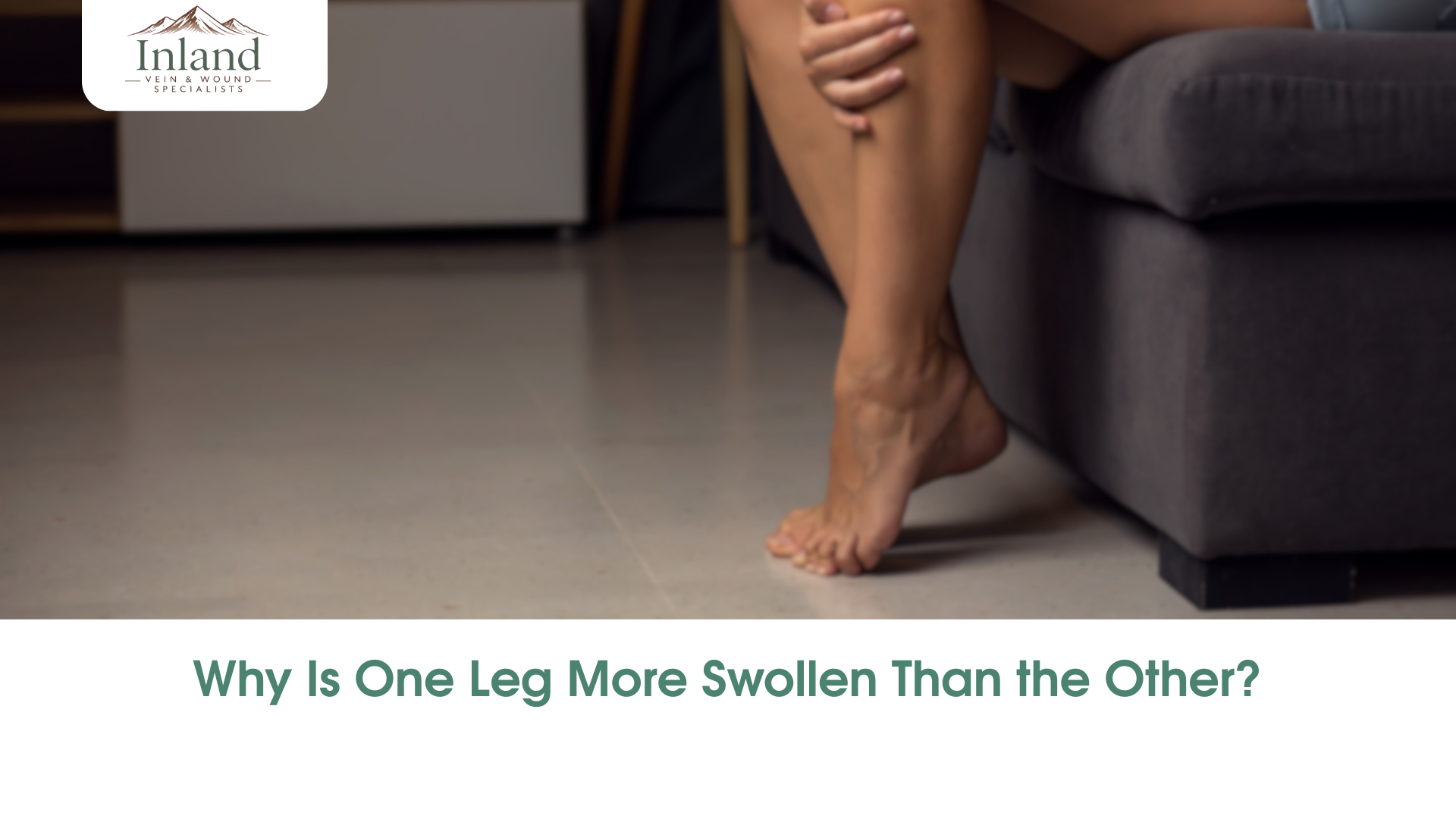 Why Is One Leg More Swollen Than the Other?