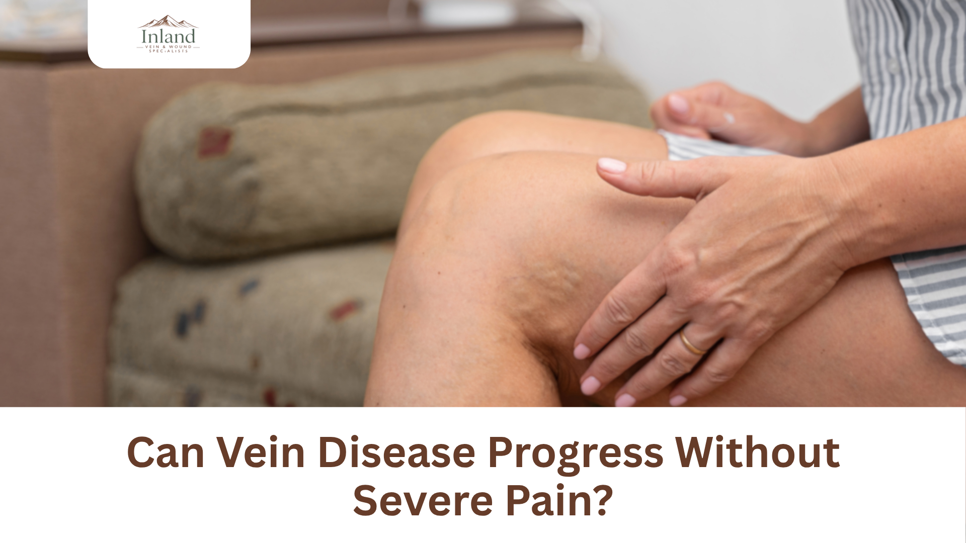 Can Vein Disease Progress Without Severe Pain?