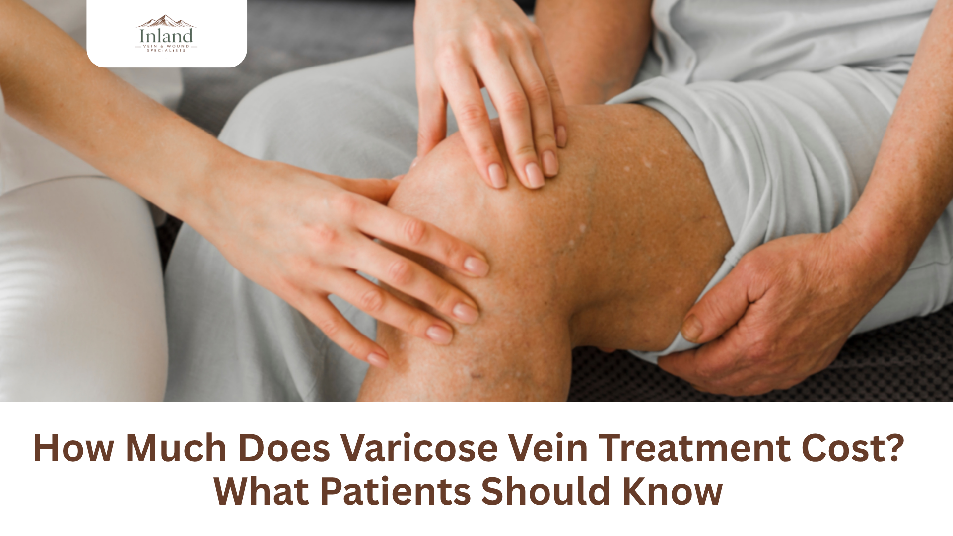 How Much Does Varicose Vein Treatment Cost? What Patients Should Know