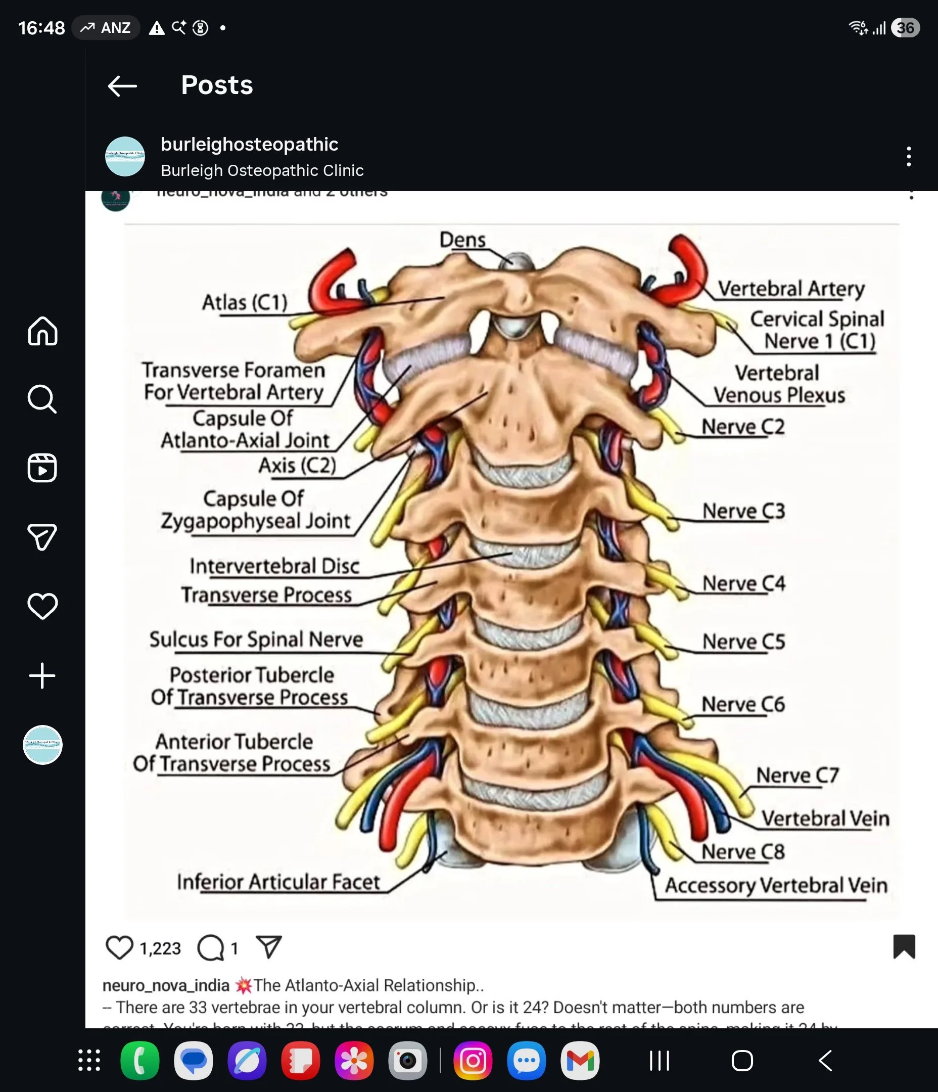 Diagram of human cervical spine showing vertebrae, nerves, arteries, and other structures with labels for various parts.