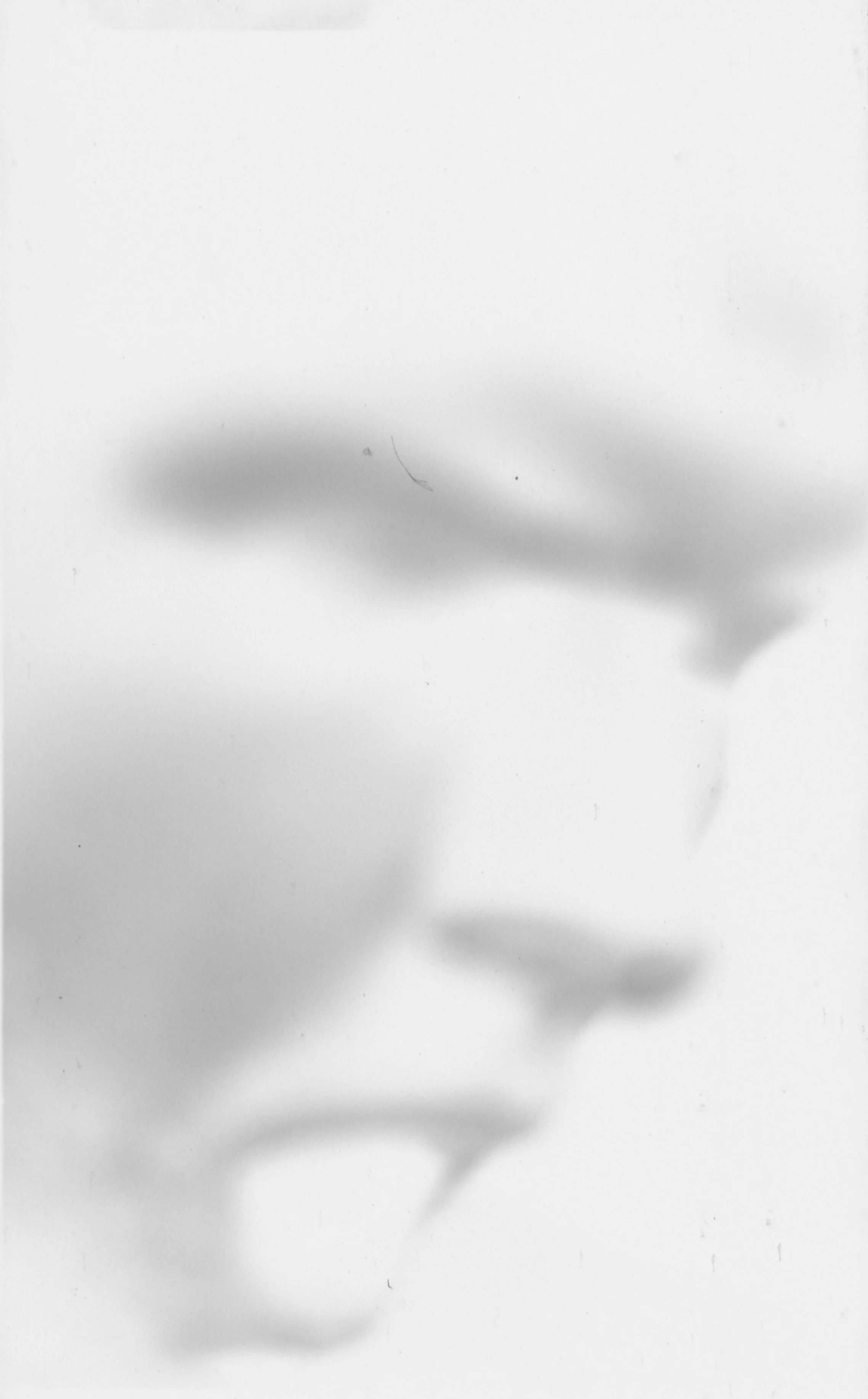 Blurry black and white photo of a person's face with glasses, with shadows cast on the face.