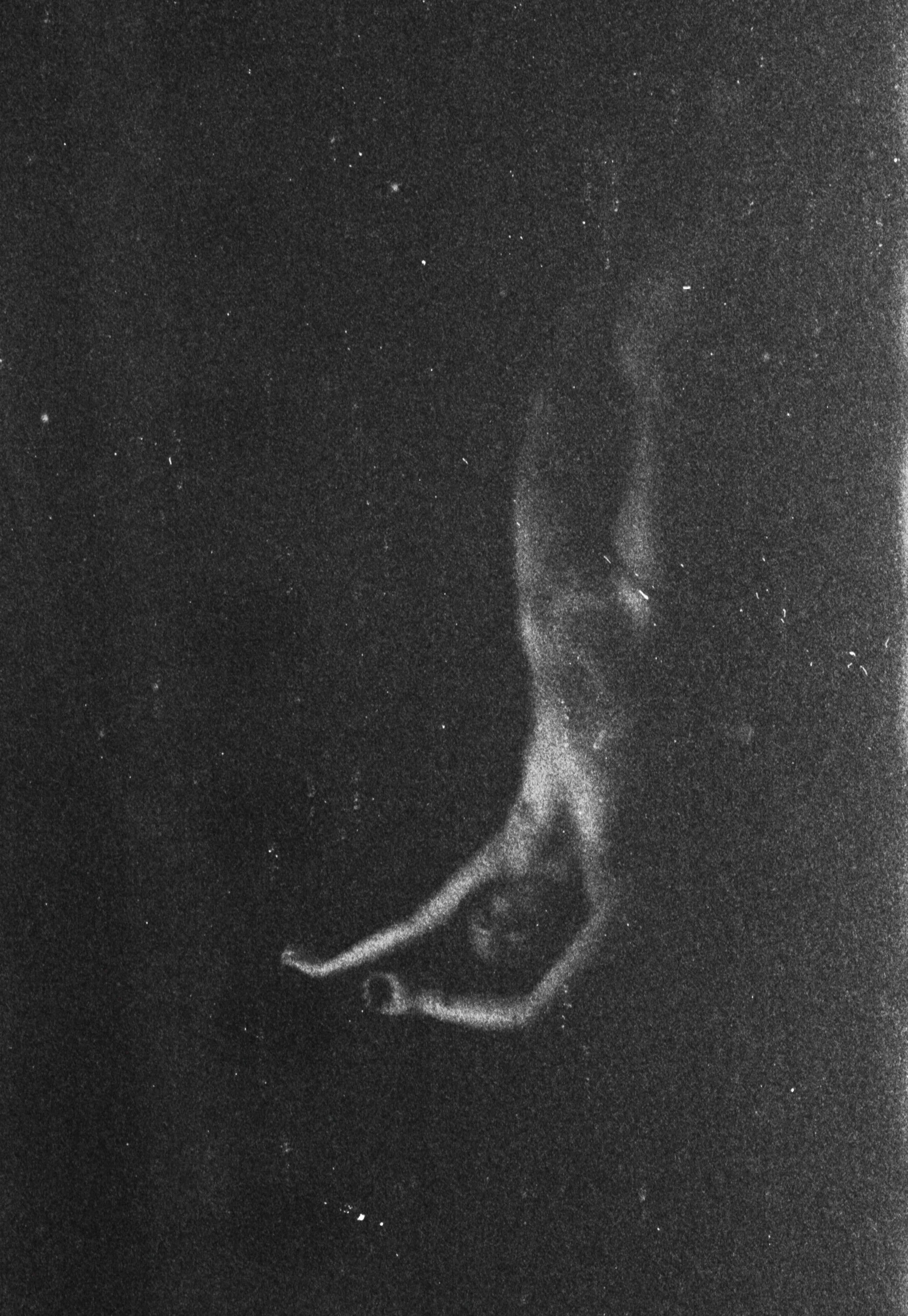 A black and white photograph of a person whose face is partially visible and slightly out of focus, with a starry background.
