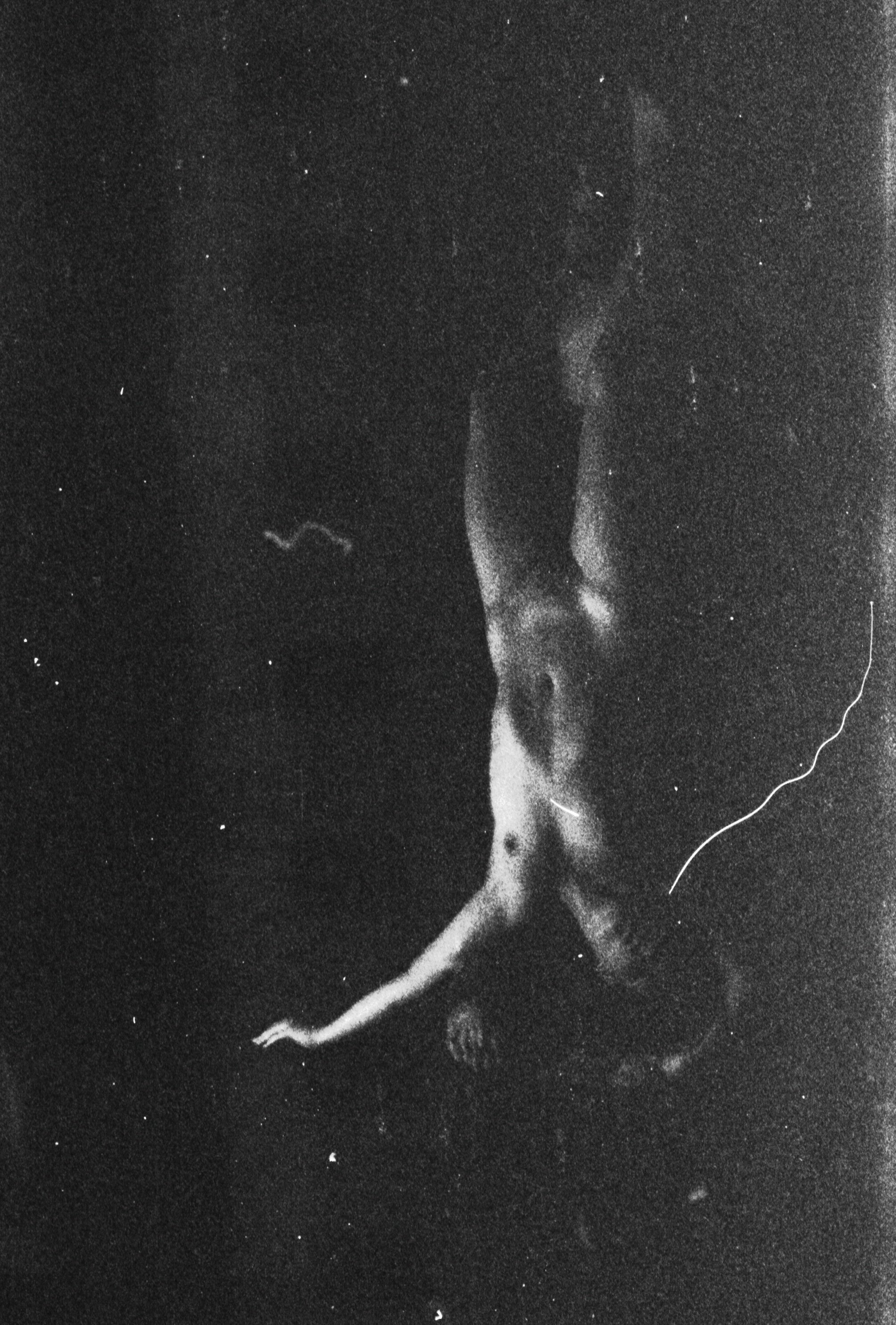Black and white photograph of a human fetus floating in space, with cosmic stars surrounding it.