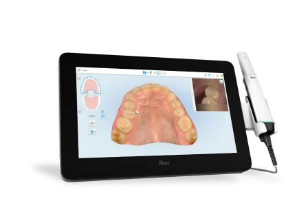 Dental scanner displaying a 3D digital model of a patient's upper teeth and gums.